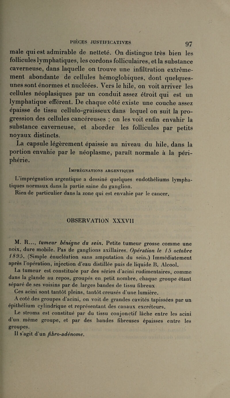 / PIÈGES JUSTIFICATIVES 97 male qui est admirable de netteté. On distingue très bien les follicules lymphatiques, les cordons folliculaires, et la substance caverneuse, dans laquelle on trouve une infiltration extrême¬ ment abondante de cellules hémoglobiques, dont quelques- unes sont énormes et nucléées. Vers le hile, on voit arriver les cellules néoplasiques par un conduit assez étroit qui est un lymphatique efférent. De chaque côté existe une couche assez épaisse de tissu cellulo-graisseux dans lequel on suit la pro¬ gression des cellules cancéreuses ; on les voit enfin envahir la substance caverneuse, et aborder les follicules par petits noyaux distincts. La capsule légèrement épaissie au niveau du hile, dans la portion envahie par le néoplasme, paraît normale à la péri- Imprégnations argentiques L imprégnation argentique a dessiné quelques endothéliums lympha¬ tiques normaux dans la partie saine du ganglion. Rien de particulier dans la zone qui est envahie par le cancer. OBSERVATION XXXVII M. R..., tumeur bénigne du sein. Petite tumeur grosse comme une noix, dure mobile. Pas de ganglions axillaires. Opération le 15 octobre 1895. (Simple énucléation sans amputation du sein.) Immédiatement après l’opération, injection d’eau distillée puis de liquide B, Alcool. La tumeur est constituée par des séries d’acini rudimentaires, comme dans la glande au repos, groupés en petit nombre, chaque groupe étant séparé de ses voisins par de larges bandes de tissu fibreux Ces acini sont tantôt pleins, tantôt creusés d’une lumière. A coté des groupes d’acini, on voit de grandes cavités tapissées par un épithélium cylindrique et représentant des canaux excréteurs. Le stroma est constitué par du tissu conjonctif lâche entre les acini d’un, même groupe, et par des bandes fibreuses épaisses entre les groupes. Il s’agit d’un fibro-adénome.