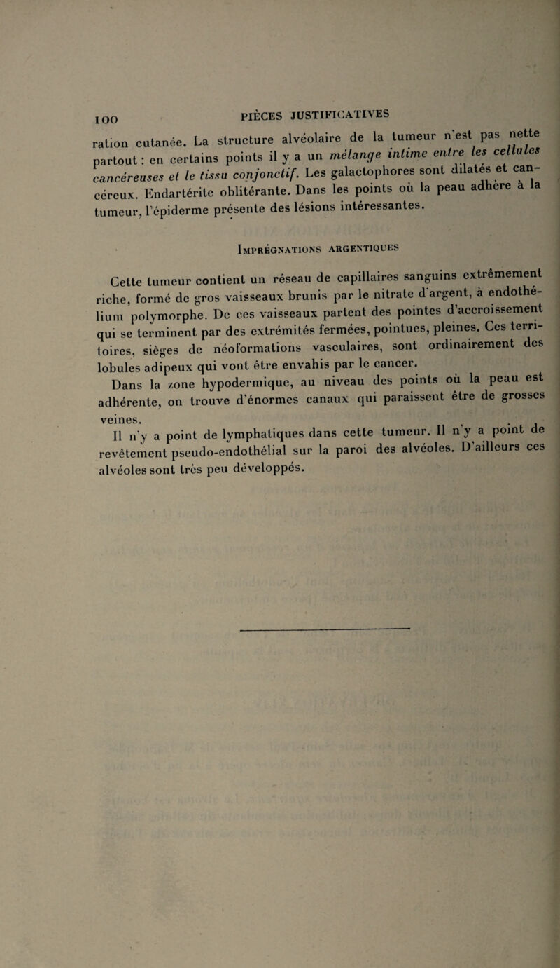 IOO ration cutanée. La structure alvéolaire de la tumeur n'est pas nette partout : en certains points il y a un mélange intime entre les ce Iules cancéreuses et le tissu conjonctif. Les galactophores sont dilates et can céreux. Endartérite oblitérante. Dans les points où la peau adhéré a la tumeur, l’épiderme présente des lésions intéressantes. Imprégnations argentiques Cette tumeur contient un réseau de capillaires sanguins extrêmement riche, formé de gros vaisseaux brunis par le nitrate d’argent, à endothé¬ lium polymorphe. De ces vaisseaux partent des pointes d’accroissement qui se terminent par des extrémités fermées, pointues, pleines. Ces terri¬ toires, sièges de néoformations vasculaires, sont ordinairement des lobules adipeux qui vont être envahis par le cancer. Dans la zone hypodermique, au niveau des points où la peau est adhérente, on trouve d’énormes canaux qui paraissent être de grosses veines. i . Il n’y a point de lymphatiques dans cette tumeur. Il n y a point de revêtement pseudo-endothélial sur la paroi des alvéoles. D ailleurs ces alvéoles sont très peu développés.