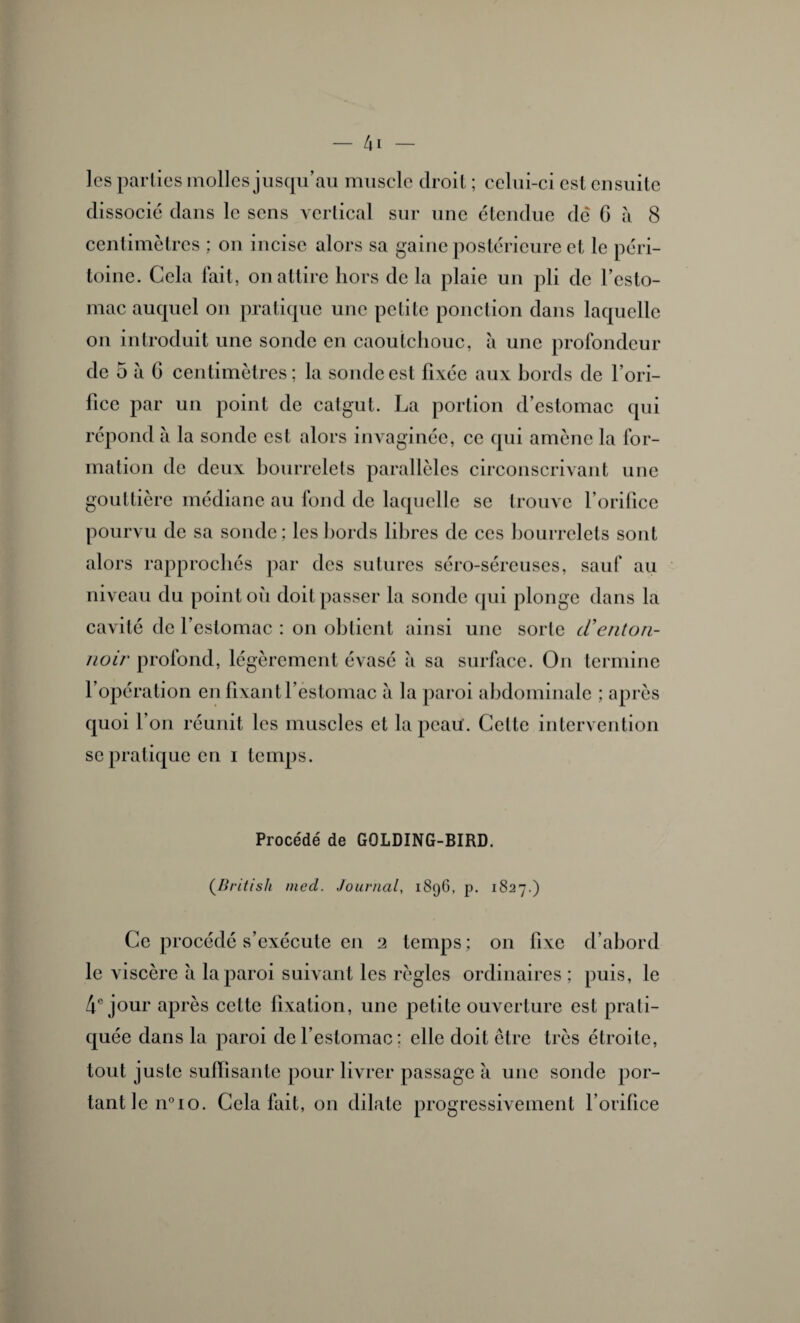 les parties molles jusqu’au muscle droit ; celui-ci est ensuite dissocié dans le sens vertical sur une étendue dé G à 8 centimètres ; on incise alors sa gaine postérieure et le péri¬ toine. Cela fait, on attire hors de la plaie un pli de l’esto¬ mac auquel on pratique une petite ponction dans laquelle on introduit une sonde en caoutchouc, à une profondeur de 5 à 6 centimètres; la sonde est fixée aux bords de l’ori¬ fice par un point de catgut. La portion d’estomac qui répond à la sonde est alors invaginée, ce qui amène la for¬ mation de deux bourrelets parallèles circonscrivant une gouttière médiane au fond de laquelle se trouve l’orifice pourvu de sa sonde; les bords libres de ces bourrelets sont alors rapprochés par des sutures séro-séreuses, sauf au niveau du point où doit passer la sonde qui plonge dans la cavité de l’estomac : on obtient ainsi une sorte cCenton¬ noir profond, légèrement évasé à sa surface. On termine l’opération en fixant l’estomac à la paroi abdominale ; après quoi l’on réunit les muscles et la peau. Cette intervention se pratique en i temps. Procédé de GOLDING-BIRD. (British mcd. Journal, 1896, p. 1827.) Ce procédé s’exécute en 2 temps ; on fixe d’abord le viscère à la paroi suivant les règles ordinaires ; puis, le 4° jour après cette fixation, une petite ouverture est prati¬ quée dans la paroi de l’estomac: elle doit être très étroite, tout juste suffisante pour livrer passage à une sonde por¬ tant le n°io. Cela fait, on dilate progressivement l’orifice