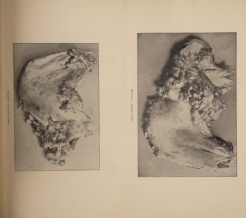 Stomach. — Anterior View