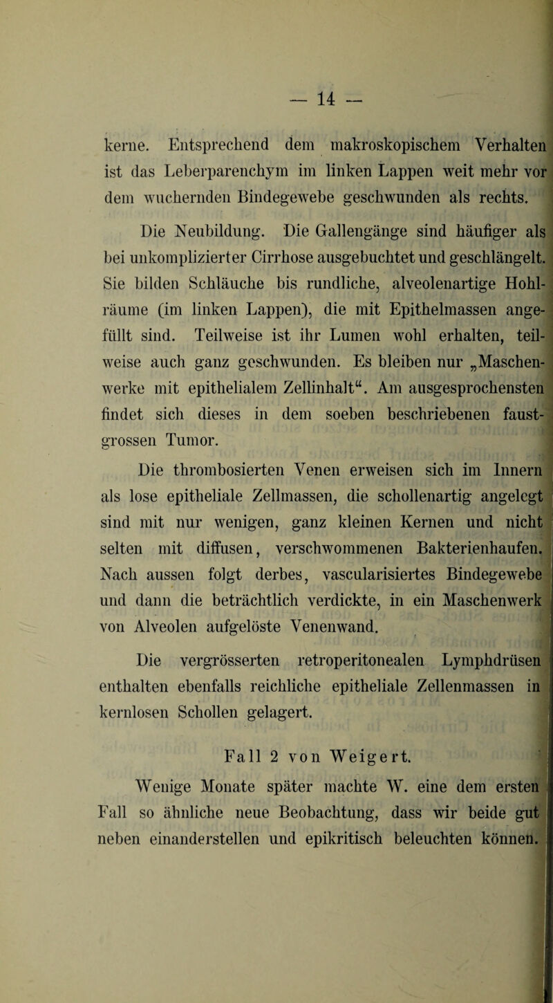 kerne. Entsprechend dem makroskopischem Verhalten ist das Leberparenchym im linken Lappen weit mehr vor dem wuchernden Bindegewebe geschwunden als rechts. Die Neubildung. Die Gallengänge sind häufiger als hei unkomplizierter Cirrhose ausgebuchtet und geschlängelt. Sie bilden Schläuche bis rundliche, alveolenartige Hohl- räume (im linken Lappen), die mit Epithelmassen ange¬ füllt sind. Teilweise ist ihr Lumen wohl erhalten, teil¬ weise auch ganz geschwunden. Es bleiben nur „Maschen¬ werke mit epithelialem Zellinhalt“. Am ausgesprochensten findet sich dieses in dem soeben beschriebenen faust¬ grossen Tumor. Die thrombosierten Venen erweisen sich im Innern als lose epitheliale Zellmassen, die schollenartig angelegt sind mit nur wenigen, ganz kleinen Kernen und nicht selten mit diffusen, verschwommenen Bakterienhaufen. Nach aussen folgt derbes, vascularisiertes Bindegewebe und dann die beträchtlich verdickte, in ein Maschenwerk von Alveolen aufgelöste Venenwand. Die vergrösserten retroperitonealen Lymphdrüsen enthalten ebenfalls reichliche epitheliale Zellenmassen in kernlosen Schollen gelagert. Fall 2 von Weigert. Wenige Monate später machte W. eine dem ersten j Fall so ähnliche neue Beobachtung, dass wir beide gut neben einanderstellen und epikritisch beleuchten können. (