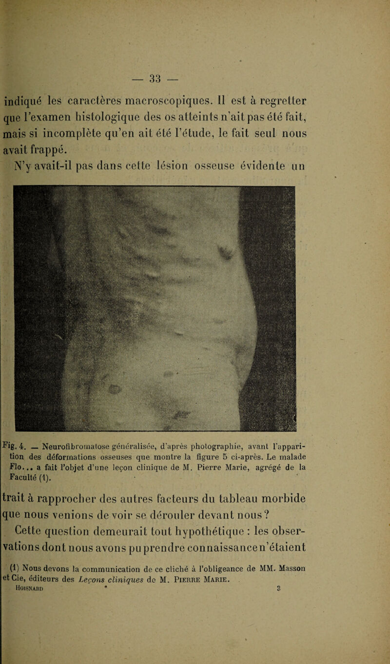 indiqué les caractères macroscopiques. 11 est à regretter que l’examen histologique des os atteints n’ait pas été fait, mais si incomplète qu’en ait été l’étude, le fait seul nous avait frappé. N’y avait-il pas dans cette lésion osseuse évidente un Fig. 4. — Neurofibromatose généralisée, d’après photographie, avant l’appari¬ tion des déformations osseuses que montre la figure 5 ci-après. Le malade Flo... a fait l’objet d’une leçon clinique de M. Pierre Marie, agrégé de la Faculté (1). trait à rapprocher des autres facteurs du tableau morbide que nous venions de voir se dérouler devant nous? Cette question demeurait tout hypothétique : les obser¬ vations dont nous avons pu pren dre connaissance n’étaient (1) Nous devons la communication de ce cliché à l’obligeance de MM. Masson et Cie, éditeurs des Leçons cliniques de M. Pierre Marie. . Hoisnadd * 3