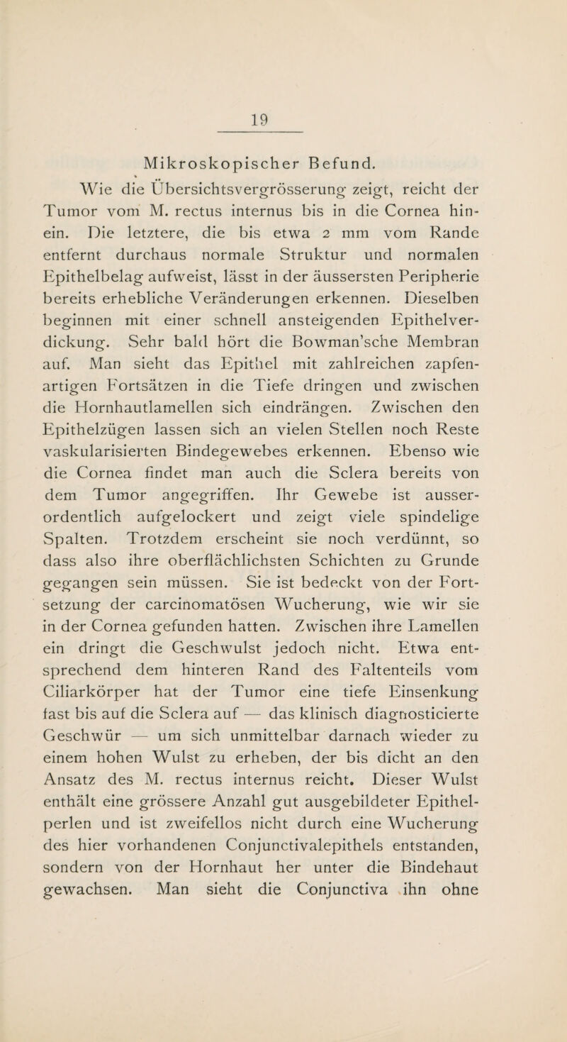 Mikroskopischer Befund. % • • Wie die Ubersichtsvergrösserung zeigt, reicht der Tumor vom M. rectus internus bis in die Cornea hin¬ ein. Die letztere, die bis etwa 2 mm vom Rande entfernt durchaus normale Struktur und normalen Epithelbelag aufweist, lässt in der äussersten Peripherie bereits erhebliche Veränderungen erkennen. Dieselben beginnen mit einer schnell ansteigenden Epithelver¬ dickung. Sehr bald hört die Bowman’sche Membran auf. Man sieht das Epithel mit zahlreichen zapfen- artigen Fortsätzen in die Tiefe dringen und zwischen die Hornhautlamellen sich eindrängen. Zwischen den Epithelzügen lassen sich an vielen Stellen noch Reste vaskularisierten Bindegewebes erkennen. Ebenso wie die Cornea findet man auch die Sclera bereits von dem Tumor angegriffen. Ihr Gewebe ist ausser¬ ordentlich aufgelockert und zeigt viele spindelige Spalten. Trotzdem erscheint sie noch verdünnt, so dass also ihre oberflächlichsten Schichten zu Grunde gegangen sein müssen. Sie ist bedeckt von der Fort- setzung der carcinomatösen Wucherung, wie wir sie in der Cornea gefunden hatten. Zwischen ihre Lamellen ein dringt die Geschwulst jedoch nicht. Etwa ent¬ sprechend dem hinteren Rand des Faltenteils vom Ciliarkörper hat der Tumor eine tiefe Einsenkung fast bis auf die Sclera auf — das klinisch diagnosticierte Geschwür — um sich unmittelbar darnach wieder zu einem hohen Wulst zu erheben, der bis dicht an den Ansatz des M. rectus internus reicht. Dieser Wulst enthält eine grössere Anzahl gut ausgebildeter Epithel¬ perlen und ist zweifellos nicht durch eine Wucherung des hier vorhandenen Conjunctivalepithels entstanden, sondern von der Hornhaut her unter die Bindehaut gewachsen. Man sieht die Conjunctiva ihn ohne