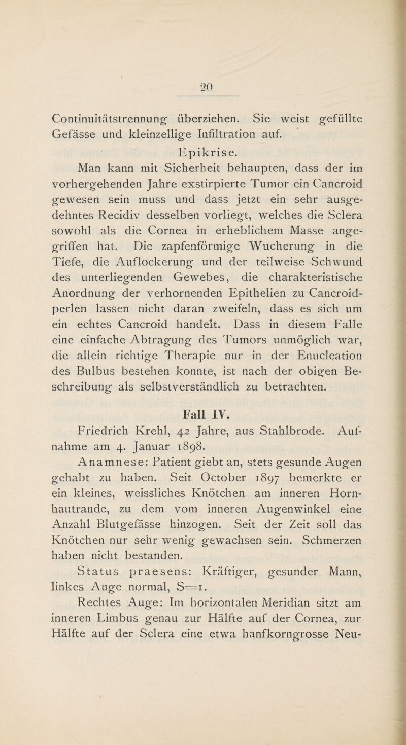 Continuitätstrennung überziehen. Sie weist gefüllte Gefässe und kleinzellige Infiltration auf. Epikrise. Man kann mit Sicherheit behaupten, dass der im vorhergehenden Jahre exstirpierte Tumor ein Cancroid gewesen sein muss und dass jetzt ein sehr ausge¬ dehntes Recidiv desselben vorliegt, welches die Sclera sowohl als die Cornea in erheblichem Masse ange¬ griffen hat. Die zapfenförmige Wucherung in die Tiefe, die Auflockerung und der teilweise Schwund des unterliegenden Gewebes, die charakteristische Anordnung der verhornenden Epithelien zu Cancroid- perlen lassen nicht daran zweifeln, dass es sich um ein echtes Cancroid handelt. Dass in diesem Falle eine einfache Abtragung des Tumors unmöglich war, die allein richtige Therapie nur in der Enucleation des Bulbus bestehen konnte, ist nach der obigen Be¬ schreibung als selbstverständlich zu betrachten. Fall IY. Friedrich Krehl, 42 Jahre, aus Stahlbrode. Auf¬ nahme am 4. Januar 1898. Anamnese: Patient giebt an, stets gesunde Augen gehabt zu haben. Seit October 1897 bemerkte er ein kleines, weissliches Knötchen am inneren Horn¬ hautrande, zu dem vom inneren Augenwinkel eine Anzahl Blutgefässe hinzogen. Seit der Zeit soll das Knötchen nur sehr wenig gewachsen sein. Schmerzen haben nicht bestanden. Status praesens: Kräftiger, gesunder Mann, linkes Auge normal, S=i. Rechtes Auge: Im horizontalen Meridian sitzt am inneren Limbus genau zur Plälfte auf der Cornea, zur Hälfte auf der Sclera eine etwa hanfkorngrosse Neu-