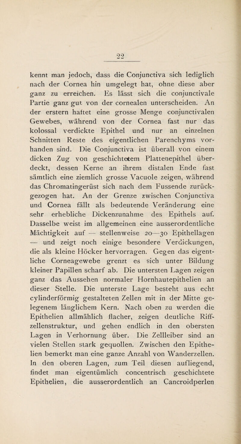 kennt man jedoch, dass die Conjunctiva sich lediglich nach der Cornea hin umgelegt hat, ohne diese aber ganz zu erreichen. Es lässt sich die conjunctivale Partie ganz gut von der cornealen unterscheiden. An der erstem haftet eine grosse Menge conjunctivalen Gewebes, während von der Cornea fast nur das kolossal verdickte Epithel und nur an einzelnen Schnitten Reste des eigentlichen Parenchyms vor¬ handen sind. Die Conjunctiva ist überall von einem dicken Zug von geschichtetem Plattenepithel über¬ deckt, dessen Kerne an ihrem distalen Ende fast sämtlich eine ziemlich grosse Vacuole zeigen, während das Chromatingerüst sich nach dem Fussende zurück¬ gezogen hat. An der Grenze zwischen Conjunctiva und Cornea fällt als bedeutende Veränderung eine sehr erhebliche Dickenzunahme des Epithels auf. Dasselbe weist im allgemeinen eine ausserordentliche Mächtigkeit auf — stellenweise 20—30 Epithellagen — und zeigt noch einige besondere Verdickungen, die als kleine Höcker hervorragen. Gegen das eigent¬ liche Corneagewebe grenzt es sich unter Bildung kleiner Papillen scharf ab. Die untersten Lagen zeigen ganz das Aussehen normaler Hornhautepithelien an dieser Stelle. Die unterste Lage besteht aus echt cylinderförmig gestalteten Zellen mit in der Mitte ge¬ legenem länglichem Kern. Nach oben zu werden die Epithelien allmählich flacher, zeigen deutliche Riff¬ zellenstruktur, und gehen endlich in den obersten Lagen in Verhornung über. Die Zellleiber sind an vielen Stellen stark gequollen. Zwischen den Epithe¬ lien bemerkt man eine ganze Anzahl von Wanderzellen. In den oberen Lagen, zum Teil diesen aufliegend, findet man eigentümlich concentrisch geschichtete Epithelien, die ausserordentlich an Cancroidperlen