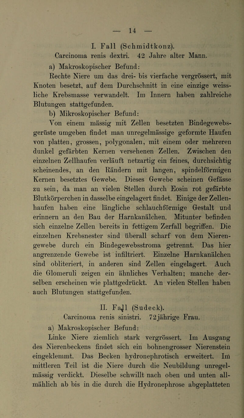 I. Fall (Schmidtkonz). Carcinoma renis dextri. 42 Jahre alter Mann. a) Makroskopischer Befund: Rechte Niere um das drei- bis vierfache vergrössert, mit Knoten besetzt, auf dem Durchschnitt in eine einzige weiss- liclie Krebsmasse verwandelt. Im Innern haben zahlreiche Blutungen stattgefunden. b) Mikroskopischer Befund: Von einem massig mit Zellen besetzten Bindegewebs- gerüste umgeben findet man unregelmässige geformte Haufen von platten, grossen, polygonalen, mit einem oder mehreren dunkel gefärbten Kernen versehenen Zellen. Zwischen den einzelnen Zellhaufen verläuft netzartig ein feines, durchsichtig scheinendes, an den Rändern mit langen, spindelförmigen Kernen besetztes Gewebe. Dieses Gewebe scheinen Gefässe zu sein, da man an vielen Stellen durch Eosin rot gefärbte Blutkörperchen in dasselbe eingelagert findet. Einige der Zellen¬ haufen haben eine längliche schlauchförmige Gestalt und erinnern an den Bau der Harnkanälchen. Mitunter befinden sich einzelne Zellen bereits in fettigem Zerfall begriffen. Die einzelnen Krebsnester sind überall scharf von dem Nieren¬ gewebe durch ein Bindegewebsstroma getrennt. Das hier angrenzende Gewebe ist infiltriert. Einzelne Harnkanälchen * * •, sind obliteriert, in anderen sind Zellen eingelagert. Auch die Glomeruli zeigen ein ähnliches Verhalten; manche der¬ selben erscheinen wie plattgedrückt. An vielen Stellen haben auch Blutungen stattgefunden. II. Fa^l (Sudeck). Carcinoma renis sinistri. 72jährige Frau. a) Makroskopischer Befund: Linke Niere ziemlich stark vergrössert. Im Ausgang des Nierenbeckens findet sich ein bohnengrosser Nierenstein eingeklemmt. Das Becken hydroneplirotisch erweitert. Im mittleren Teil ist die Niere durch die Neubildung unregel¬ mässig verdickt. Dieselbe schwillt nach oben und unten all¬ mählich ab bis in die durch die Hydronephrose abgeplatteten