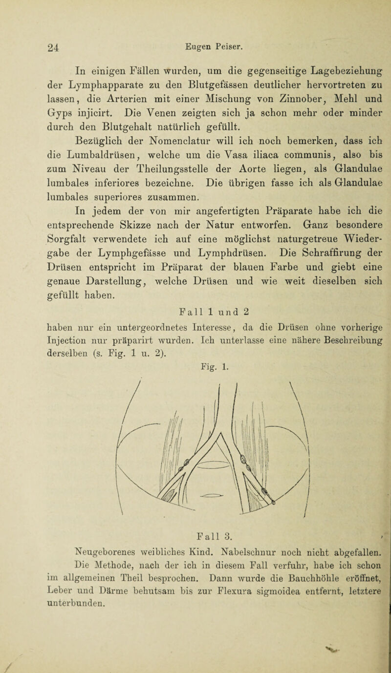 In einigen Fällen wurden, um die gegenseitige Lagebeziehung der Lymphapparate zu den Blutgefässen deutlicher hervortreten zu lassen, die Arterien mit einer Mischung von Zinnober, Mehl und Gyps injicirt. Die Venen zeigten sich ja schon mehr oder minder durch den Blutgehalt natürlich gefüllt. Bezüglich der Nomenclatur will ich noch bemerken, dass ich die Lumbaldrüsen, welche um die Vasa iliaca communis, also bis zum Niveau der Theilungsstelle der Aorte liegen, als Glandulae lumbales inferiores bezeichne. Die übrigen fasse ich als Glandulae lumbales superiores zusammen. In jedem der von mir angefertigten Präparate habe ich die entsprechende Skizze nach der Natur entworfen. Ganz besondere Sorgfalt verwendete ich auf eine möglichst naturgetreue Wieder¬ gabe der Lymphgefässe und Lymphdrüsen. Die Schraffirung der Drüsen entspricht im Präparat der blauen Farbe und giebt eine genaue Darstellung, welche Drüsen und wie weit dieselben sich gefüllt haben. Fall 1 und 2 haben nur ein untergeordnetes Interesse, da die Drüsen ohne vorherige Injection nur präparirt wurden. Ich unterlasse eine nähere Beschreibung derselben (s. Fig. 1 u. 2). Fi g. 1. Neugeborenes weibliches Kind. Nabelschnur noch nicht abgefallen. Die Methode, nach der ich in diesem Fall verfuhr, habe ich schon im allgemeinen Theil besprochen. Dann wurde die Bauchhöhle eröffnet, Leber und Därme behutsam bis zur Flexura sigmoidea entfernt, letztere unterbunden.
