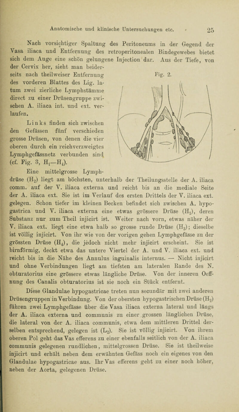 Nach vorsichtiger Spaltung des Peritoneums in der Gegend der \asa iliaca und Entfernung des retroperitonealen Bindegewebes bietet sich dem Auge eine schön gelungene Injection dar. Aus der Tiefe, von der Cervix her, sieht man beider¬ seits nach theilweiser Entfernung Fig. 2. des vorderen Blattes des Lig. la- tum zwei zierliche Lymphstämme direct zu einer Drüsengruppe zwi¬ schen A. iliaca int. und ext. ver¬ laufen. Links finden sich zwischen den Gefässen fünf verschieden grosse Drüsen, von denen die vier oberen durch ein reichverzweigtes Lymphgefässnetz verbunden sind (cf. Fig. 3, Hj—HJ. Eine mittelgrosse Lymph- drüse (HJ liegt am höchsten, unterhalb der Theilungsstelle der A. iliaca comm. auf der V. iliaca externa und reicht bis an die mediale Seite der A. iliaca ext. Sie ist im Verlauf des ersten Drittels der V. iliaca ext. gelegen. Schon tiefer im kleinen Becken befindet sich zwischen A. hypo- gastrica und V. iliaca externa eine etwas grössere Drüse (HJ, deren Substanz nur zum Theil injicirt ist. Weiter nach vorn, etwas näher der V. iliaca ext. liegt eine etwa halb so grosse runde Drüse (H3); dieselbe ist völlig injicirt. Von ihr wie von der vorigen gehen Lymphgefässe zu der grössten Drüse (HJ, die jedoch nicht mehr injicirt erscheint. Sie ist bimförmig, deckt etwa das untere Viertel der A. und V. iliaca ext. und reicht bis in die Nähe des Annulus inguinalis internus. — Nicht injicirt und ohne Verbindungen liegt am tiefsten am lateralen Rande des N. obturatorius eine grössere etwas längliche Drüse. Von der inneren Oeff- nung des Canalis obturatorius ist sie noch ein Stück entfernt. Diese Glandulae hypogastricae treten nun secundär mit zwei anderen Drüsengruppen in Verbindung. Von der obersten hypogastrischen Drüse (HJ führen zwei Lymphgefässe über die Vasa iliaca externa lateral und längs der A. iliaca externa und communis zu einer grossen länglichen Drüse, die lateral von der A. iliaca communis, etwa dem mittleren Drittel der¬ selben entsprechend, gelegen ist (LJ. Sie ist völlig injicirt. Von ihrem oberen Pol geht das Vas efferens zu einer ebenfalls seitlich von der A. iliaca communis gelegenen rundlichen, mittelgrossen Drüse. Sie ist theilweise injicirt und erhält neben dem erwähnten Gefäss noch ein eigenes von den Glandulae hypogastricae aus. Ihr Vas efferens geht zu einer noch höher, neben der Aorta, gelegenen Drüse.
