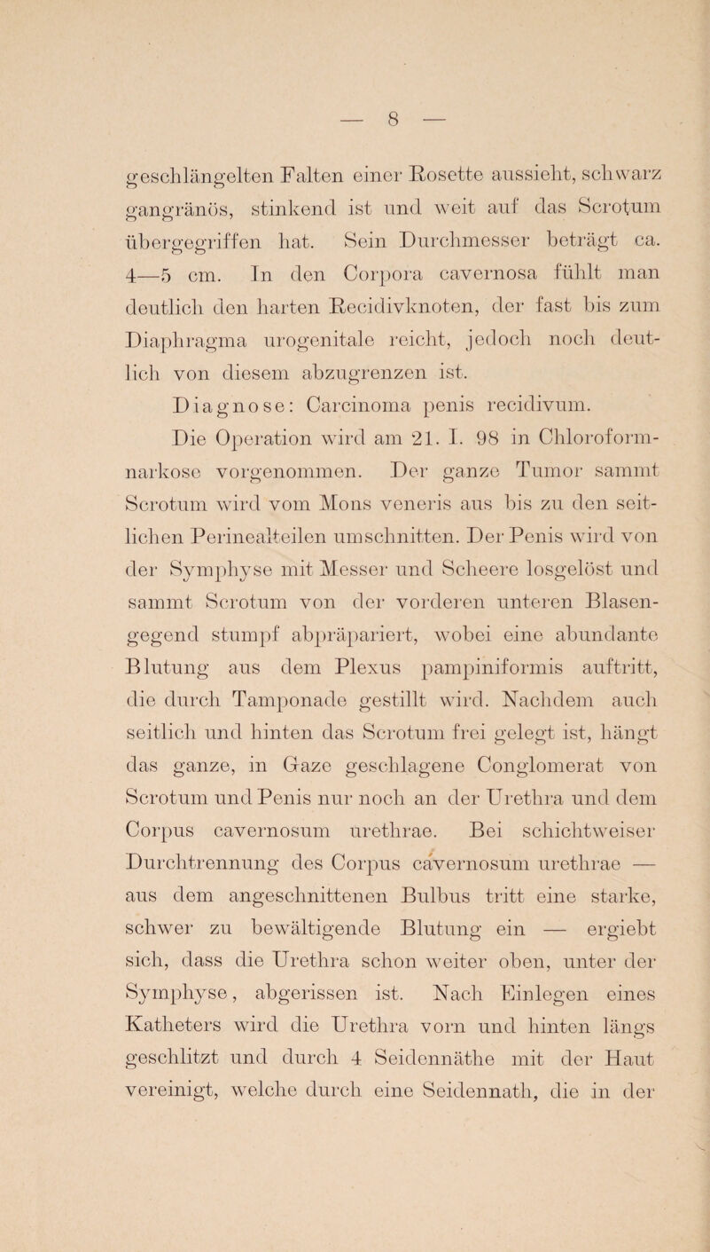 geschlängelten Falten einer Rosette anssieht, schwarz gangränös, stinkend ist und weit auf das Scrofum übergegriffen hat. Sein Durchmesser beträgt ca. 4—5 cm. In den Corpora cavernosa fühlt man deutlich den harten Recidivknoten, der fast bis zum Diaphragma urogenitale reicht, jedoch noch deut¬ lich von diesem abzugrenzen ist. Diagnose: Carcinoma penis recidivum. Die Operation wird am 21. I. 98 in Chloroform¬ narkose vorgenommen. Der ganze Tumor sammt Scrotum wird vom Mons veneris aus bis zu den seit¬ lichen Perinealteilen Umschnitten. Der Penis wird von der Symphyse mit Messer und Scheere losgelöst und sammt Scrotum von der vorderen unteren Blasen¬ gegend stumpf abpräpariert, wobei eine abundante Blutung aus dem Plexus pampiniformis auftritt, die durch Tamponade gestillt wird. Nachdem auch seitlich und hinten das Scrotum frei gelegt ist, hängt das ganze, in Gaze geschlagene Conglomerat von Scrotum und Penis nur noch an der Urethra und dem Corpus cavernosum urethrae. Bei schichtweiser Durchtrennung des Corpus cavernosum urethrae — aus dem angeschnittenen Bulbus tritt eine starke, schwer zu bewältigende Blutung ein — ergiebt sich, dass die Urethra schon weiter oben, unter der Symphyse, abgerissen ist. Nach Einlegen eines Katheters wird die Urethra vorn und hinten längs geschlitzt und durch 4 Seidennäthe mit der Haut vereinigt, welche durch eine Seidennath, die in der V