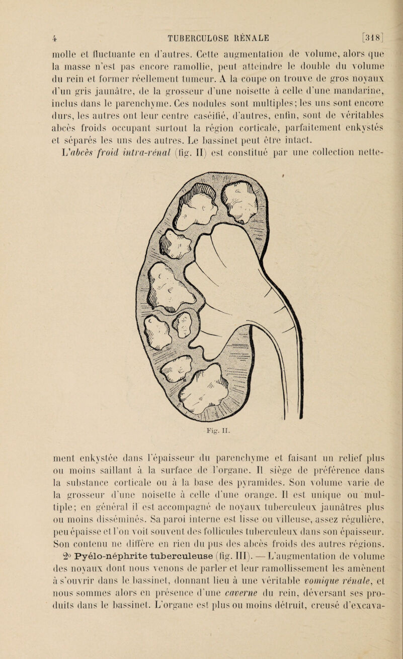 molle et fluctuante en d’autres. Cette augmentation de volume, alors que la masse n’est pas encore ramollie, peut atteindre le double du volume du rein et former réellement tumeur. A la coupe on trouve de gros noyaux d’un gris jaunâtre, de la grosseur d’une noisette à celle d’une mandarine, inclus dans le parenchyme. Ces nodules sont multiples; les uns sont encore durs, les autres ont leur centre caséifié, d’autres, enfin, sont de véritables abcès froids occupant surtout la région corticale, parfaitement enkystés et séparés les uns des autres. Le bassinet peut être intact. L'abcès froid intra-rénal (fig. II) est constitué par une collection nette¬ ment enkystée dans l’épaisseur du parenchyme et faisant un relief plus ou moins saillant à la surface de l’organe. Il siège de préférence dans la substance corticale ou à la base des pyramides. Son volume varie de la grosseur d’une noisette à celle d’une orange. Il est unique ou mul¬ tiple; en général il est accompagné de noyaux tuberculeux jaunâtres plus ou moins disséminés. Sa paroi interne est lisse ou villeuse, assez régulière, peu épaisse et l’on voit souvent des follicules tuberculeux dans son épaisseur. Son contenu ne diffère en rien du pus des abcès froids des autres régions. 2° Pyélo-néphrite tuberculeuse (fig. III). — L’augmentation de volume des noyaux dont nous venons de parler et leur ramollissement les amènent à s’ouvrir dans le bassinet, donnant lieu à une véritable vomique rénale, et nous sommes alors en présence d’une caverne du rein, déversant ses pro¬ duits dans le bassinet. L’organe est plus ou moins détruit, creusé d’excava-