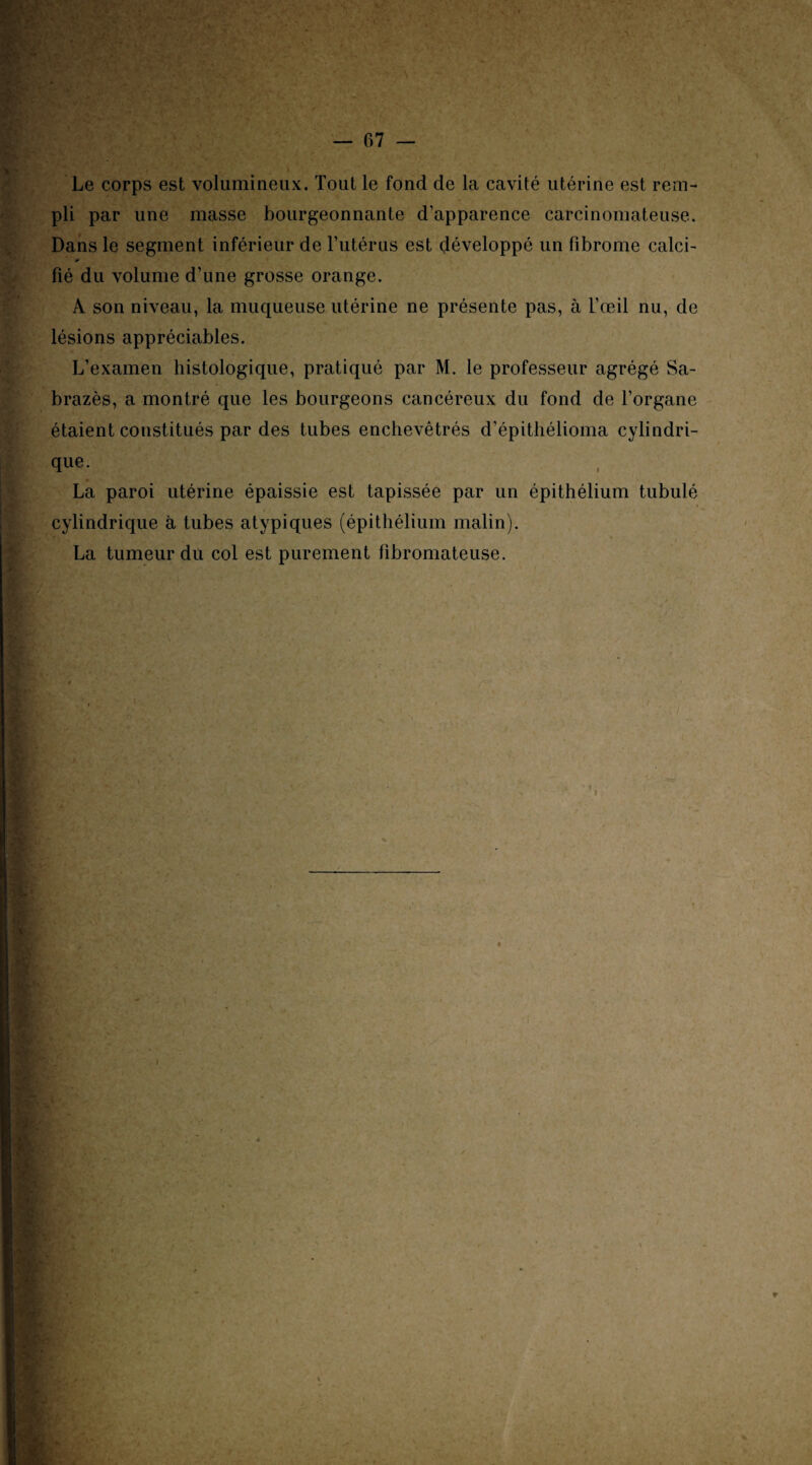 Le corps est volumineux. Tout le fond de la cavité utérine est rem¬ pli par une masse bourgeonnante d’apparence carcinomateuse. Dans le segment inférieur de l'utérus est développé un fibrome calci¬ fié du volume d’une grosse orange. A son niveau, la muqueuse utérine ne présente pas, à L’œil nu, de lésions appréciables. L’examen histologique, pratiqué par M. le professeur agrégé Sa- brazès, a montré que les bourgeons cancéreux du fond de l’organe étaient constitués par des tubes enchevêtrés d’épithélioma cylindri¬ que. La paroi utérine épaissie est tapissée par un épithélium tubulé cylindrique à tubes atypiques (épithélium malin). La tumeur du col est purement fibromateuse.