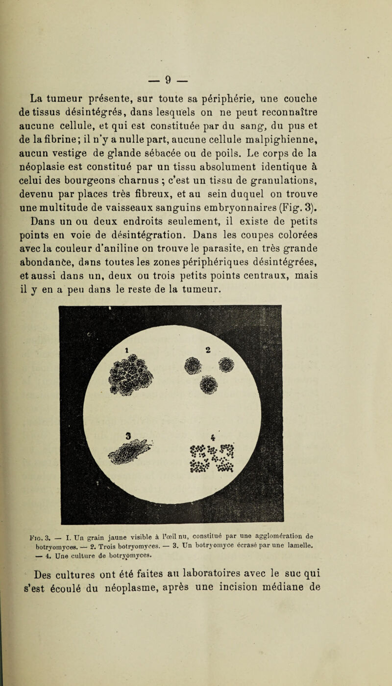 La tumeur présente, sur toute sa périphérie, une couche de tissus désintégrés, dans lesquels on ne peut reconnaître aucune cellule, et qui est constituée par du sang, du pus et de la fibrine ; il n’y a nulle part, aucune cellule malpighienne, aucun vestige de glande sébacée ou de poils. Le corps de la néoplasie est constitué par un tissu absolument identique à celui des bourgeons charnus ; c’est un tissu de granulations, devenu par places très fibreux, et au sein duquel on trouve une multitude de vaisseaux sanguins embryonnaires (Fig. 3). Dans un ou deux endroits seulement, il existe de petits points en voie de désintégration. Dans les coupes colorées avec la couleur d’aniline on trouve le parasite, en très grande abondance, dans toutes les zones périphériques désintégrées, et aussi dans un, deux ou trois petits points centraux, mais il y en a peu dans le reste de la tumeur. Fig. 3. — I. Un grain jaune visible à l’œil nu, constitué par une agglomération de botryomyces. — 2. Trois botryomyoes. — 3. Un botryomyce écrasé par une lamelle. — 4. Une culture de botryomyces. Des cultures ont été faites au laboratoires avec le suc qui s’est écoulé du néoplasme, après une incision médiane de