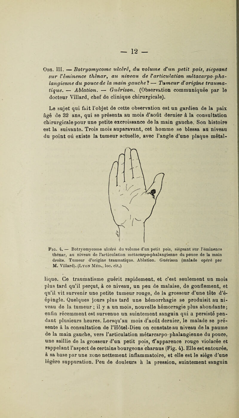 Obs. III. — Botryomycome ulcéré, du volume d'un petit pois, siégeant sur Véminence thénar, au niveau de Varticulation métacarpo-pha¬ langienne du pouce de la main gauche ? — Tumeur d'origine trauma¬ tique. — Ablation. — Guérison. (Observation communiquée par le docteur Villard, chef de clinique chirurgicale). Le sujet qui fait l’objet de cette observation est un gardien de la paix âgé de 32 ans, qui se présenta au mois d’août dernier à la consultation chirurgicale pour une petite excroissance delà main gauche. Son histoire est la suivante. Trois mois auparavant, cet homme se blessa au niveau du point où existe la tumeur actuelle, avec l’angle d’une plaque métal- Fig. 4. — Botryomycome ulcéré du volume d’un petit pois, siégeant sur l’éminence thénar, au niveau de l’articulation métacarpo-phalangienne du pouce de la main droite. Tumeur d’origine traumatique. Ablation. Guérison (malade opéré par M. Villard). (Lyon Méd., loc. cit.) îique. Ce traumatisme guérit rapidement, et c’est seulement un mois plus tard qu’il perçut, à ce niveau, un peu de malaise, de gonflement, et qu’il vit survenir une petite tumeur rouge, de la grosseur d’une tète d’é- épingle. Quelques jours plus tard une hémorrhagie se produisit au ni¬ veau de la tumeur ; il y a un mois, nouvelle hémorragie plus abondante; enfin récemment est survenue un suintement sanguin qui a persisté pen¬ dant plusieurs heures. Lorsqu’au mois d’août dernier, le malade se pré¬ sente à la consultation de l'Hôtel-Dieu on constate au niveau delà paume de la main gauche, vers l’articulation métarcarpo-phalangienne du pouce, une saillie de la grosseur d’un petit pois, fl’apparence rouge violacée et rappelant l'aspect de certains bourgeons charnus (Fig. 4). Elle est entourée, à sa base par une zone nettement inflammatoire, et elle est le siège d’une légère suppuration. Peu de douleurs à la pression, suintement sanguin