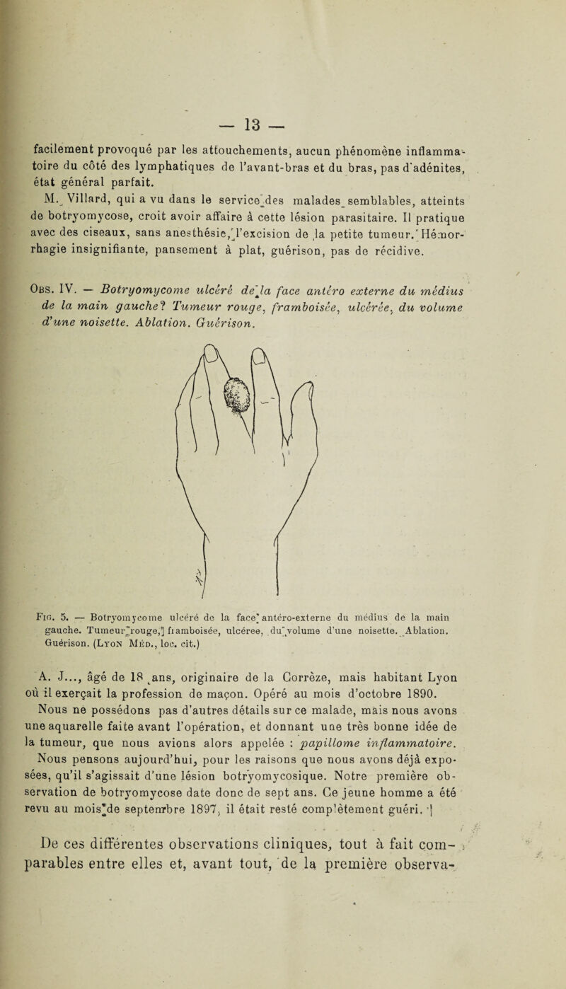 facilement provoqué par les attouchements, aucun phénomène inflamma¬ toire du côté des lymphatiques de l’avant-bras et du bras, pas d'adénites, état général parfait. M. Vil lard, qui a vu dans le service_des malades_ semblables, atteints de botryomycose, croit avoir affaire à cette lésion parasitaire. Il pratique avec des ciseaux, sans anesthésie, l’excision de ,1a petite tumeur.'Hémor¬ rhagie insignifiante, pansement à plat, guérison, pas de récidive. Obs. IV. — Botryomycome ulcéré déjà face antero externe du médius de la main gauche? Tumeur rouge, framhoisée, ulcérée.t du volume d’une noisette. Ablation. Guérison. Fin. 5. — Botryomycome ulcéré de la face’ antéro-externe du médius de la main gauche. Tumeur'rouge,] fiamboisée, ulcéree, duvolume d’une noisette. Ablation. Guérison. (Lyon Méd., loc. cit.) A. J..., âgé de 18 Lans, originaire de la Corrèze, mais habitant Lyon où il exerçait la profession de maçon. Opéré au mois d’octobre 1890. Nous ne possédons pas d’autres détails sur ce malade, mais nous avons une aquarelle faite avant l’opération, et donnant uüe très bonne idée de la tumeur, que nous avions alors appelée : papillome inflammatoire. Nous pensons aujourd’hui, pour les raisons que nous avons déjà expo¬ sées, qu’il s’agissait d’une lésion botryomycosique. Notre première ob¬ servation de botryomycose date donc de sept ans. Ce jeune homme a été revu au mois'de septemrbre 1897, il était resté complètement guéri. -| - * - * t De ces différentes observations cliniques, tout à fait com- : parables entre elles et, avant tout, de la première observa-