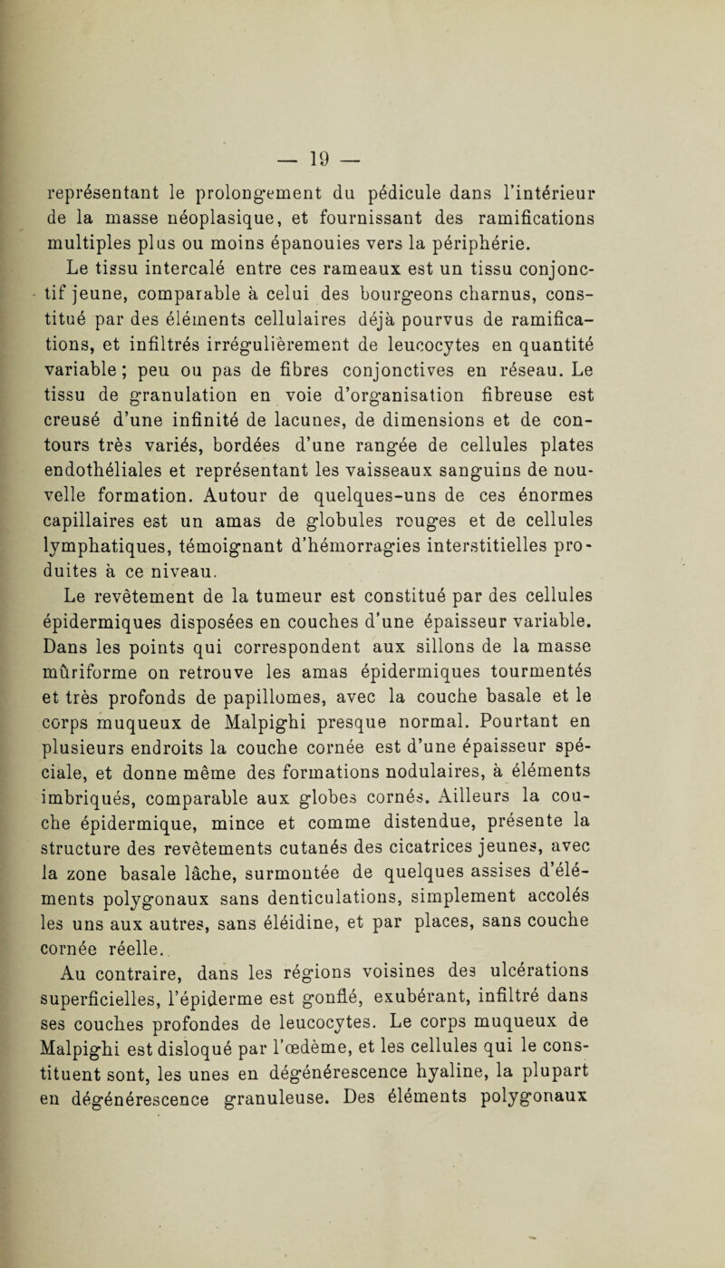 représentant le prolongement du pédicule dans l’intérieur de la masse néoplasique, et fournissant des ramifications multiples plus ou moins épanouies vers la périphérie. Le tissu intercalé entre ces rameaux est un tissu conjonc¬ tif jeune, comparable à celui des bourgeons charnus, cons¬ titué par des éléments cellulaires déjà pourvus de ramifica¬ tions, et infiltrés irrégulièrement de leucocytes en quantité variable; peu ou pas de fibres conjonctives en réseau. Le tissu de granulation en voie d’organisation fibreuse est creusé d’une infinité de lacunes, de dimensions et de con¬ tours très variés, bordées d’une rangée de cellules plates endothéliales et représentant les vaisseaux sanguins de nou¬ velle formation. Autour de quelques-uns de ces énormes capillaires est un amas de globules rouges et de cellules lymphatiques, témoignant d’hémorragies interstitielles pro¬ duites à ce niveau. Le revêtement de la tumeur est constitué par des cellules épidermiques disposées en couches d’une épaisseur variable. Dans les points qui correspondent aux sillons de la masse mûriforme on retrouve les amas épidermiques tourmentés et très profonds de papillomes, avec la couche basale et le corps muqueux de Malpighi presque normal. Pourtant en plusieurs endroits la couche cornée est d’une épaisseur spé¬ ciale, et donne même des formations nodulaires, à éléments imbriqués, comparable aux globes cornés. Ailleurs la cou¬ che épidermique, mince et comme distendue, présente la structure des revêtements cutanés des cicatrices jeunes, avec la zone basale lâche, surmontée de quelques assises d’élé¬ ments polygonaux sans denticulations, simplement accolés les uns aux autres, sans éléidine, et par places, sans couche cornée réelle. Au contraire, dans les régions voisines des ulcérations superficielles, l’épiderme est gonflé, exubérant, infiltré dans ses couches profondes de leucocytes. Le corps muqueux de Malpighi est disloqué par l’œdème, et les cellules qui le cons¬ tituent sont, les unes en dégénérescence hyaline, la plupart en dégénérescence granuleuse. Des éléments polygonaux