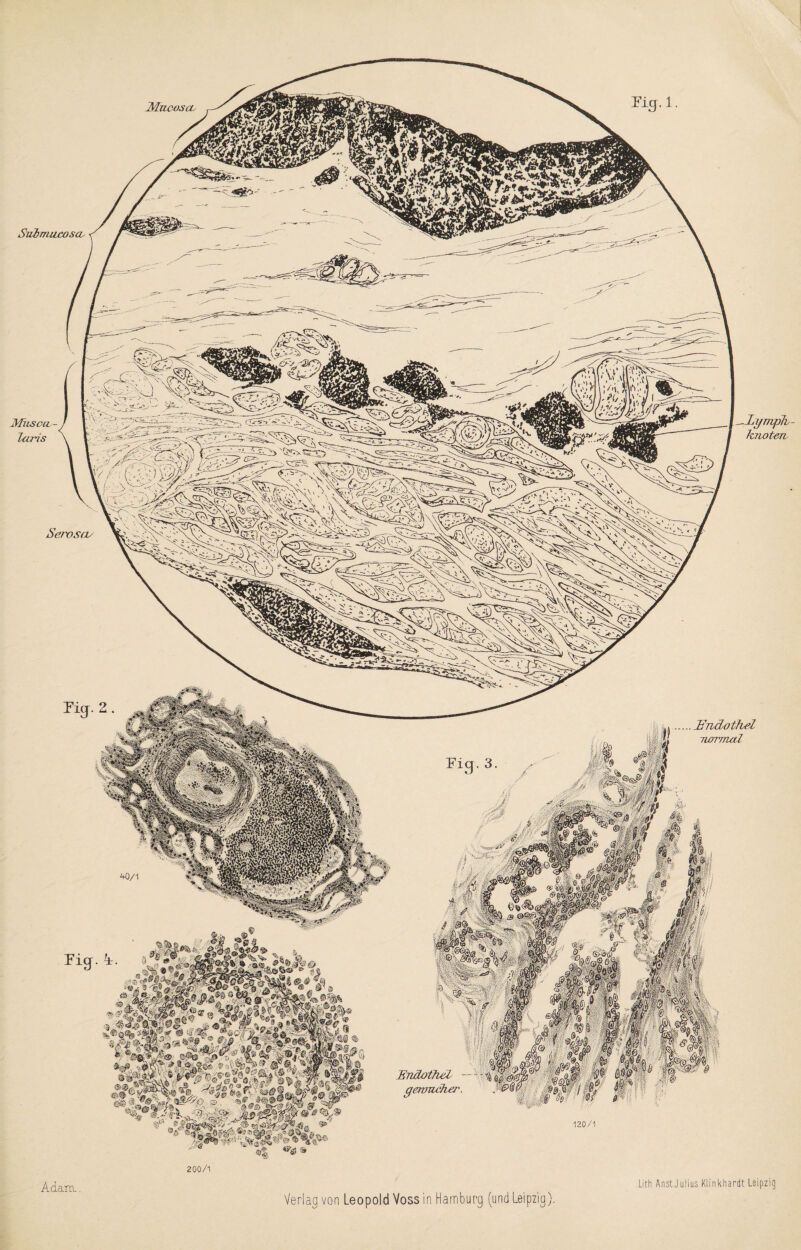 Mncoscc Sribmucoso Lyrriph knoten. Mus an Toris Seroscv Endothel normal Endothel geroncher. Adam. 200/1 Verlag von Leopold Voss in Hamburg (und Leipzig). Lith An st. Julius Klin khardt Leipzig