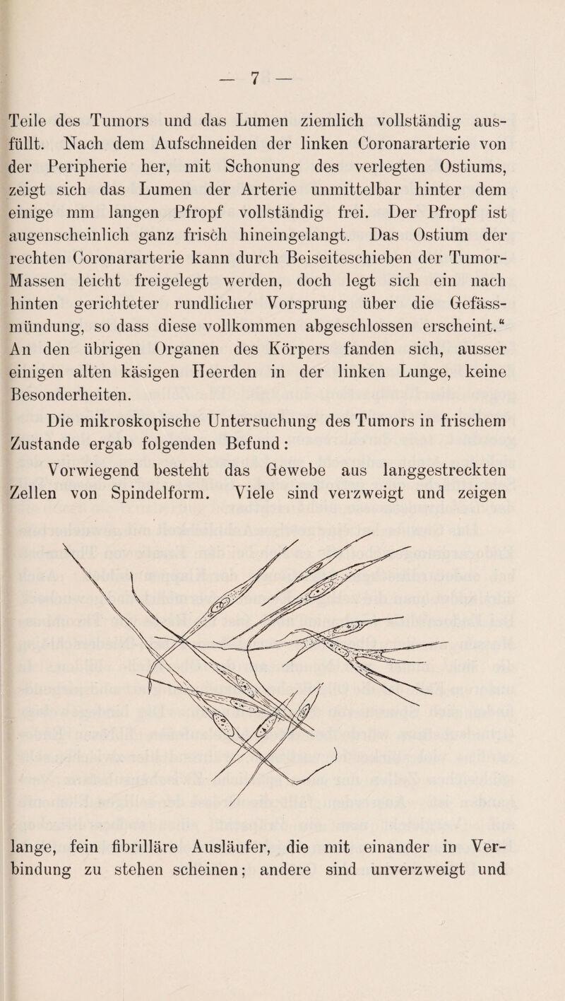 Teile des Tumors und das Lumen ziemlich vollständig aus¬ füllt. Nach dem Aufschneiden der linken Coronararterie von der Peripherie her, mit Schonung des verlegten Ostiums, zeigt sich das Lumen der Arterie unmittelbar hinter dem einige mm langen Pfropf vollständig frei. Der Pfropf ist augenscheinlich ganz frisch hineingelangt. Das Ostium der rechten Coronararterie kann durch Beiseiteschiehen der Tumor- Massen leicht freigelegt werden, doch legt sich ein nach hinten gerichteter rundlicher Vorsprung über die Gefäss- mündung, so dass diese vollkommen abgeschlossen erscheint.“ An den übrigen Organen des Körpers fanden sich, ausser einigen alten käsigen Heerden in der linken Lunge, keine Besonderheiten. Die mikroskopische Untersuchung des Tumors in frischem Zustande ergab folgenden Befund: Vorwiegend besteht das Gewebe aus langgestreckten Zellen von Spindelform. Viele sind verzweigt und zeigen lange, fein fibrilläre Ausläufer, die mit einander in Ver¬ bindung zu stehen scheinen; andere sind unverzweigt und