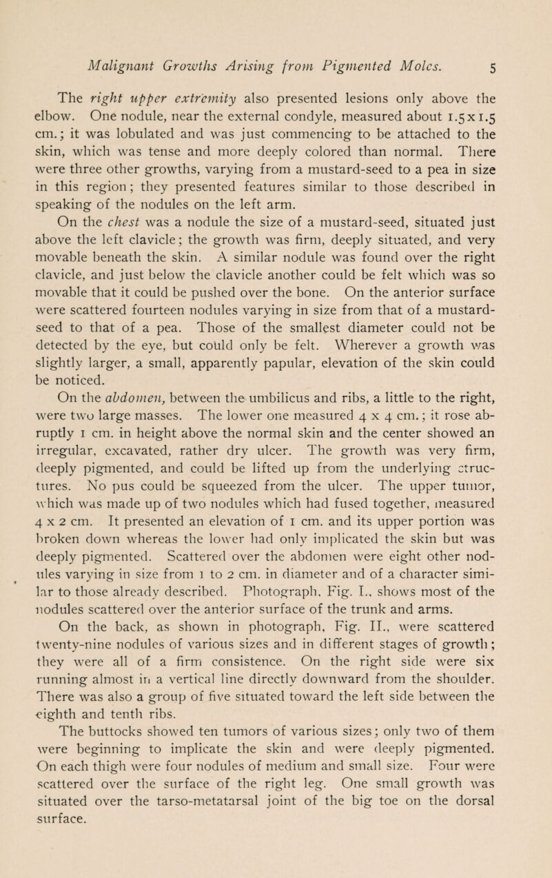 The right upper extremity also presented lesions only above the elbow. One nodule, near the external condyle, measured about 1.5 x 1.5 cm.; it was lobulated and was just commencing to be attached to the skin, which was tense and more deeply colored than normal. There were three other growths, varying from a mustard-seed to a pea in size in this region ; they presented features similar to those described in speaking of the nodules on the left arm. On the chest was a nodule the size of a mustard-seed, situated just above the left clavicle; the growth was firm, deeply situated, and very movable beneath the skin. A similar nodule was found over the right clavicle, and just below the clavicle another could be felt which was so movable that it could be pushed over the bone. On the anterior surface were scattered fourteen nodules varying in size from that of a mustard- seed to that of a pea. Those of the smallest diameter could not be detected by the eye, but could only be felt. Wherever a growth v/as slightly larger, a small, apparently papular, elevation of the skin could be noticed. On the abdomen, between the umbilicus and ribs, a little to the right, were two large masses. The lower one measured 4x4 cm.; it rose ab¬ ruptly 1 cm. in height above the normal skin and the center showed an irregular, excavated, rather dry ulcer. The growth was very firm, deeply pigmented, and could be lifted up from the underlying struc¬ tures. No pus could be squeezed from the ulcer. The upper tumor, which was made up of two nodules which had fused together, measured 4x2 cm. It presented an elevation of 1 cm. and its upper portion was broken down whereas the lower had only implicated the skin but was deeply pigmented. Scattered over the abdomen were eight other nod¬ ules varying in size from 1 to 2 cm. in diameter and of a character simi¬ lar to those already described. Photograph, Fig. I., shows most of the nodules scattered over the anterior surface of the trunk and arms. On the back, as shown in photograph, Fig. II., were scattered twenty-nine nodules of various sizes and in different stages of growth; they were all of a firm consistence. On the right side were six running almost in a vertical line directly downward from the shoulder. There was also a group of five situated toward the left side between the eighth and tenth ribs. The buttocks showed ten tumors of various sizes; only two of them were beginning to implicate the skin and were deeply pigmented. On each thigh were four nodules of medium and small size. Four were scattered over the surface of the right leg. One small growth was situated over the tarso-metatarsal joint of the big toe on the dorsal surface.
