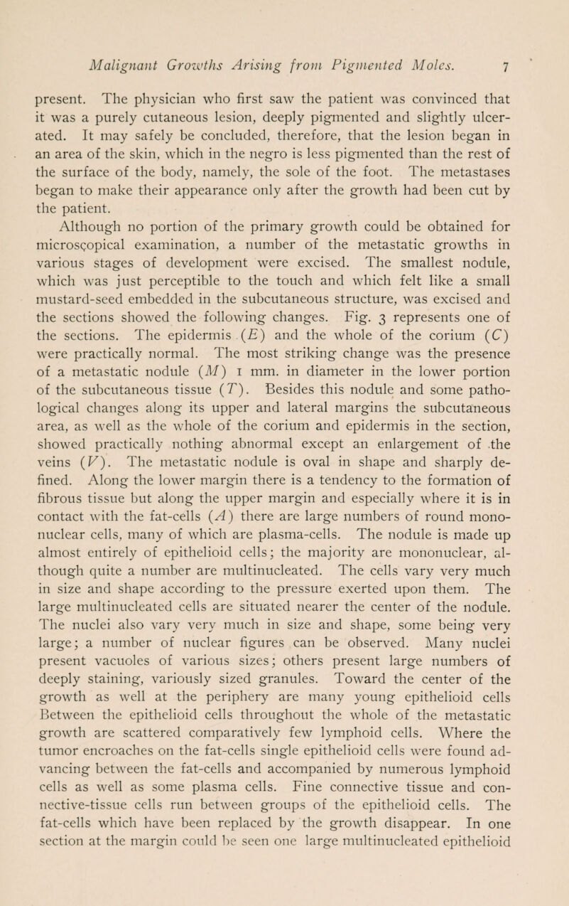 present. The physician who first saw the patient was convinced that it was a purely cutaneous lesion, deeply pigmented and slightly ulcer¬ ated. It may safely be concluded, therefore, that the lesion began in an area of the skin, which in the negro is less pigmented than the rest of the surface of the body, namely, the sole of the foot. The metastases began to make their appearance only after the growth had been cut by the patient. Although no portion of the primary growth could be obtained for microscopical examination, a number of the metastatic growths in various stages of development were excised. The smallest nodule, which was just perceptible to the touch and which felt like a small mustard-seed embedded in the subcutaneous structure, was excised and the sections showed the following changes. Fig. 3 represents one of the sections. The epidermis (£) and the whole of the corium (C) were practically normal. The most striking change was the presence of a metastatic nodule (M) 1 mm. in diameter in the lower portion of the subcutaneous tissue (T). Besides this nodule and some patho¬ logical changes along its upper and lateral margins the subcutaneous area, as well as the whole of the corium and epidermis in the section, showed practically nothing abnormal except an enlargement of .the veins (V). The metastatic nodule is oval in shape and sharply de¬ fined. Along the lower margin there is a tendency to the formation of fibrous tissue but along the upper margin and especially where it is in contact with the fat-cells (A) there are large numbers of round mono¬ nuclear cells, many of which are plasma-cells. The nodule is made up almost entirely of epithelioid cells; the majority are mononuclear, al¬ though quite a number are multinucleated. The cells vary very much in size and shape according to the pressure exerted upon them. The large multinucleated cells are situated nearer the center of the nodule. The nuclei also vary very much in size and shape, some being very large; a number of nuclear figures can be observed. Many nuclei present vacuoles of various sizes; others present large numbers of deeply staining, variously sized granules. Toward the center of the growth as well at the periphery are many young epithelioid cells Between the epithelioid cells throughout the whole of the metastatic growth are scattered comparatively few lymphoid cells. Where the tumor encroaches on the fat-cells single epithelioid cells were found ad¬ vancing between the fat-cells and accompanied by numerous lymphoid cells as well as some plasma cells. Fine connective tissue and con¬ nective-tissue cells run between groups of the epithelioid cells. The fat-cells which have been replaced by the growth disappear. In one section at the margin could be seen one large multinucleated epithelioid