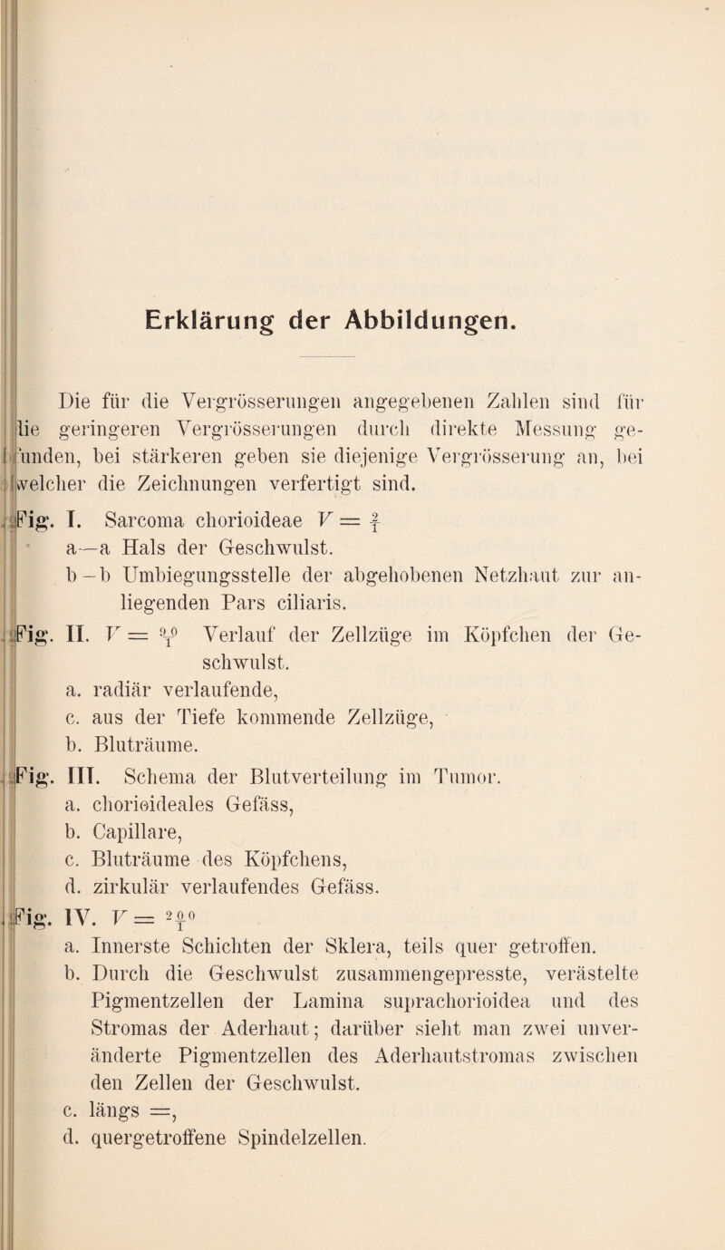 . n;_- Erklärung der Abbildungen. Die für die Vergrösserimgen angegebenen Zahlen sind für lie geringeren Vergrösserimgen durch direkte Messung ge- I linden, bei stärkeren geben sie diejenige Vergrösserung an, bei welcher die Zeichnungen verfertigt sind. ,, Fig. T. Sarcoma chorioideae V = f- a—a Hals der Geschwulst. b—b Umbiegungsstelle der abgehobenen Netzhaut zur an¬ liegenden Pars ciliaris. Fig. II. V — 9t° Verlauf der Zellzüge im Köpfchen der Ge¬ schwulst. a. radiär verlaufende, c. aus der Tiefe kommende Zellzüge, b. Bluträume. Fig. III. Schema der Blutverteilung im Tumor. a. chorioideales Gefäss, b. Capillare, c. Bluträume des Köpfchens, d. zirkulär verlaufendes Gefäss. üFig*. IV. V — 2f° a. Innerste Schichten der Sklera, teils quer getroffen. b. Durch die Geschwulst zusammengepresste, verästelte Pigmentzellen der Lamina suprachorioidea und des Stromas der Aderhaut; darüber sieht man zwei unver¬ änderte Pigmentzellen des Aderhautstromas zwischen den Zellen der Geschwulst. c. längs =, d. quergetroffene Spindelzellen.