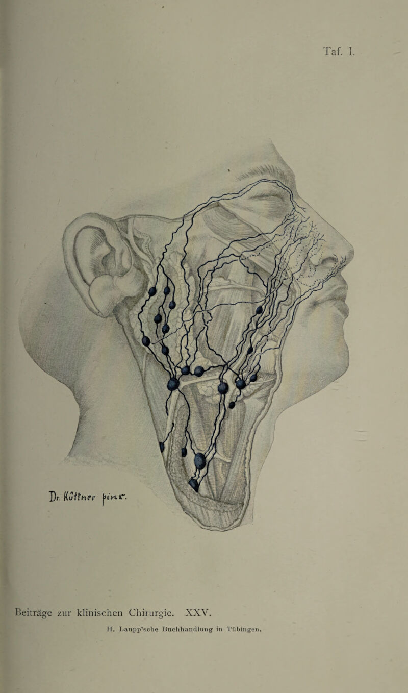 Taf. I Beitrage zur klinischen Chirurgie. XXV. Dr. Kuithcr !iwr. H. Laupp’sclae Buclihandlung in Tubingen