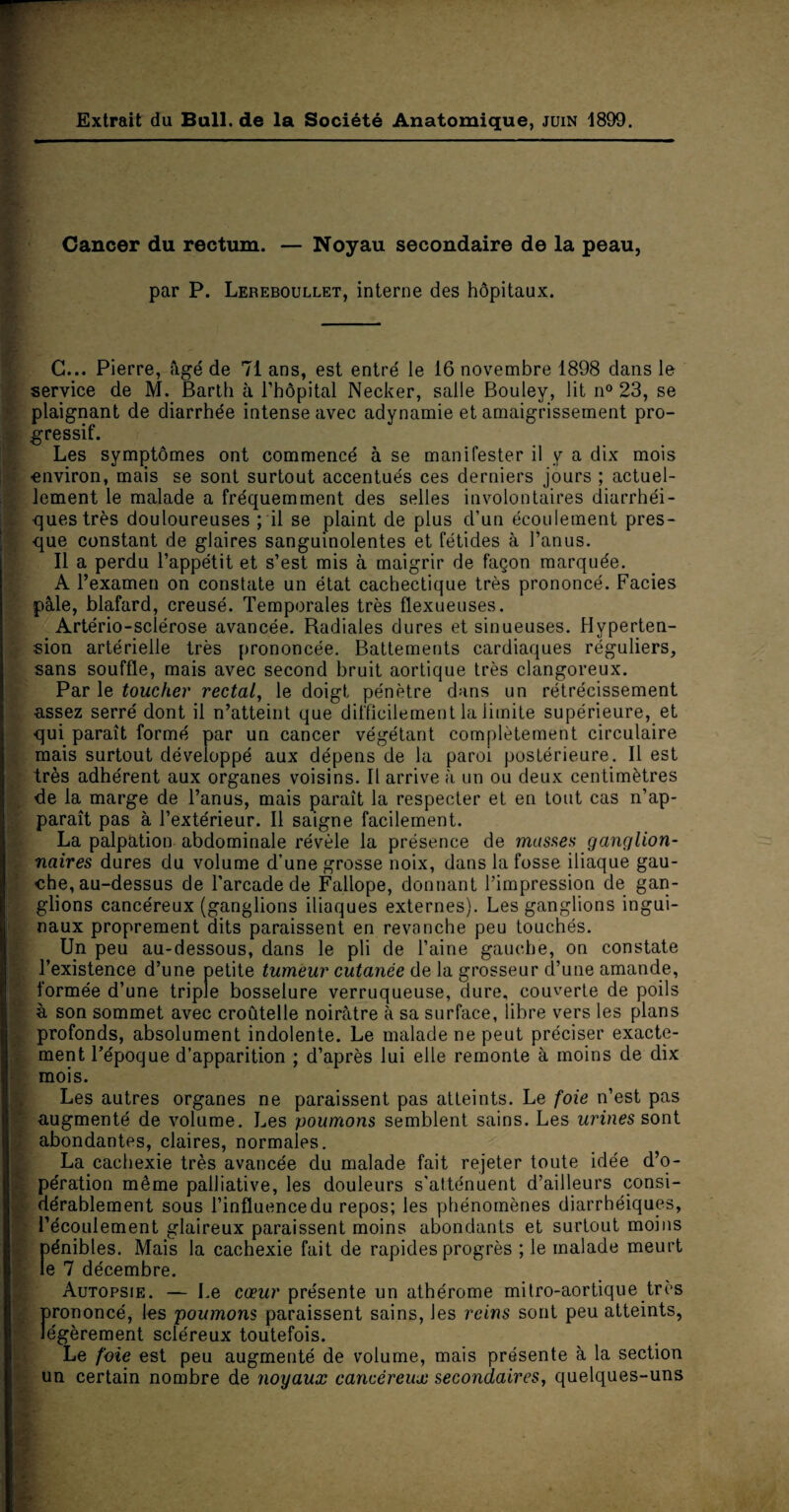 Extrait du Bull, de la Société Anatomique, juin 1899. Cancer du rectum. — Noyau secondaire de la peau, par P. Lereboullet, interne des hôpitaux. C... Pierre, âgé de 71 ans, est entré le 16 novembre 1898 dans le service de M. Barth à l’hôpital Necker, salle Bouley, lit n° 23, se plaignant de diarrhée intense avec adynamie et amaigrissement pro¬ gressif. Les symptômes ont commencé à se manifester il y a dix mois environ, mais se sont surtout accentués ces derniers jours ; actuel¬ lement le malade a fréquemment des selles involontaires diarrhéi¬ ques très douloureuses ; il se plaint de plus d’un écoulement pres¬ que constant de glaires sanguinolentes et fétides à l’anus. Il a perdu l’appétit et s’est mis à maigrir de façon marquée. A l’examen on constate un état cachectique très prononcé. Faciès pâle, blafard, creusé. Temporales très flexueuses. Artério-sclérose avancée. Radiales dures et sinueuses. Hyperten¬ sion artérielle très prononcée. Battements cardiaques réguliers, sans souffle, mais avec second bruit aortique très clangoreux. Par le toucher rectal, le doigt pénètre dans un rétrécissement assez serré dont il n’atteint que difficilement la limite supérieure, et qui paraît formé par un cancer végétant complètement circulaire mais surtout développé aux dépens de la paroi postérieure. Il est très adhérent aux organes voisins. Il arrive à un ou deux centimètres de la marge de l’anus, mais paraît la respecter et en tout cas n’ap¬ paraît pas à l’extérieur. Il saigne facilement. La palpation abdominale révèle la présence de masses ganglion¬ naires dures du volume d’une grosse noix, dans la fosse iliaque gau¬ che, au-dessus de l’arcade de Fallope, donnant l’impression de gan¬ glions cancéreux (ganglions iliaques externes). Les ganglions ingui¬ naux proprement dits paraissent en revanche peu touchés. Un peu au-dessous, dans le pli de l’aine gauche, on constate l’existence d’une petite tumeur cutanée de la grosseur d’une amande, formée d’une triple bosselure verruqueuse, dure, couverte de poils à son sommet avec croûtelle noirâtre à sa surface, libre vers les plans profonds, absolument indolente. Le malade ne peut préciser exacte¬ ment l’époque d’apparition ; d’après lui elle remonte à moins de dix mois. Les autres organes ne paraissent pas atteints. Le foie n’est pas augmenté de volume. Les poumons semblent sains. Les urines sont abondantes, claires, normales. La cachexie très avancée du malade fait rejeter toute idée d’o¬ pération même palliative, les douleurs s'atténuent d’ailleurs consi¬ dérablement sous l’influence du repos; les phénomènes diarrhéiques, l’écoulement glaireux paraissent moins abondants et surtout moins pénibles. Mais la cachexie fait de rapides progrès ; le malade meurt le 7 décembre. Autopsie. — Le cœur présente un athérome mitro-aortique très prononcé, les poumons paraissent sains, les reins sont peu atteints, légèrement scléreux toutefois. Le foie est peu augmenté de volume, mais présente à la section un certain nombre de noyaux cancéreux secondaires, quelques-uns