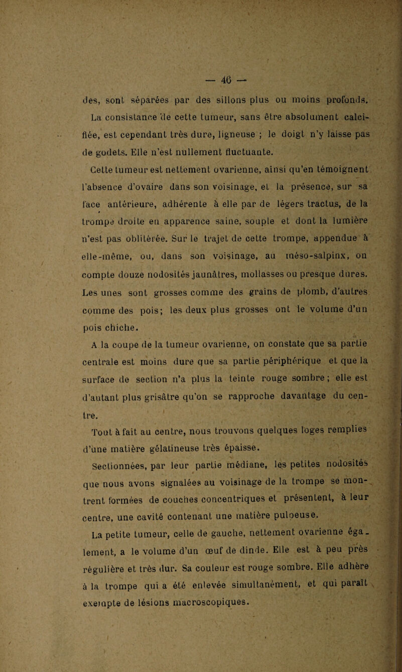 des, sont séparées par des sillons plus ou moins profonds. La consistance ‘de cette tumeur, sans être absolument calci¬ fiée, est cependant très dure, ligneuse ; le doigt n’y laisse pas de godets. Elle n’est nullement fluctuante. Cette tumeur est nettement ovarienne, ainsi qu’en témoignent l’absence d’ovaire dans son voisinage, et la présence, sur sa face antérieure, adhérente à elle par de légers tractus, de la r trompe droite eu apparence saine, souple et dont la lumière n’est pas oblitérée. Sur le trajet de cette trompe, appendue à elle-même, ou, dans son voisinage, au méso-salpinx, on compte douze nodosités jaunâtres, mollasses ou presque dures. Les unes sont grosses comme des grains de plomb, d’autres, comme des pois; les deux plus grosses ont le volume d’un pois chiche. A la coupe de la tumeur ovarienne, on constate que sa partie centrale est moins dure que sa partie périphérique et que la surface de section n’a plus la teinte rouge sombre ; elle est d’autant plus grisâtre qu’on se rapproche davantage du cen¬ tre. ' , il 4 *' ' - * ' , ' _ jr? Tout à fait au centre, nous trouvons quelques loges remplies d’une matière gélatineuse très épaisse. Sectionnées, par leur partie médiane, lçs petites nodosités que nous avons signalées au voisinage de la trompe se mon¬ trent formées de couches concentriques et présentent, à leur centre, une cavité contenant une matière puloeuse. La petite tumeur, celle de gauche, nettement ovarienne éga_ lemenfc, a le volume d’un œuf de dinde. Elle est à peu près régulière et très dur. Sa couleur est rouge sombre. Elle adhère à la trompe qui a été enlevée simultanément, et qui paraît exempte de lésions macroscopiques.