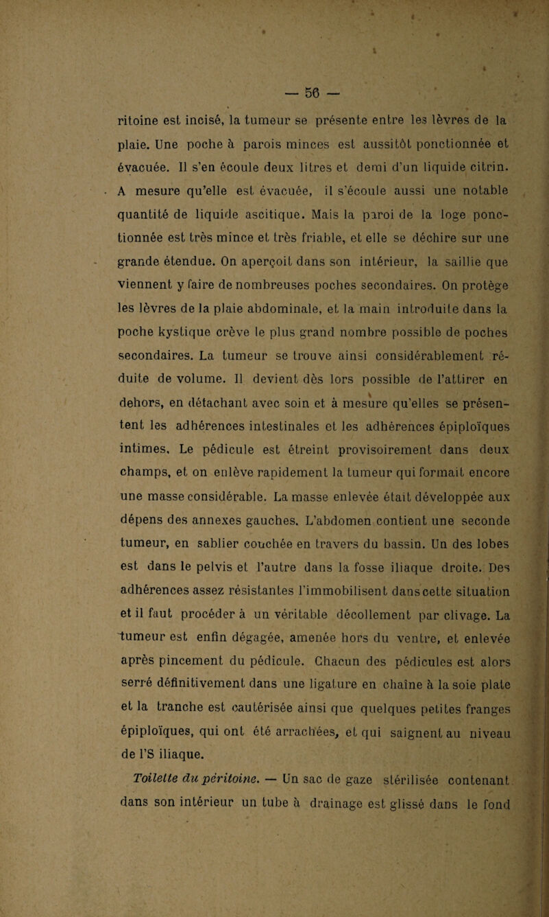 ritoine est incisé, la tumeur se présente entre les lèvres de la plaie. Une poche h parois minces est aussitôt ponctionnée et évacuée. Il s’en écoule deux litres et demi d’un liquide citrin. - A mesure qu’elle est évacuée, il s’écoule aussi une notable quantité de liquide ascitique. Mais la paroi de la loge ponc¬ tionnée est très mince et très friable, et elle se déchire sur une grande étendue. On aperçoit dans son intérieur, la saillie que viennent y faire de nombreuses poches secondaires. On protège les lèvres de la plaie abdominale, et la main introduite dans la poche kystique crève le plus grand nombre possible de poches secondaires. La tumeur se trouve ainsi considérablement ré¬ duite de volume. Il devient dès lors possible de l’attirer en dehors, en détachant avec soin et à mesure qu’elles se présen¬ tent les adhérences intestinales et les adhérences épiploïques intimes. Le pédicule est étreint provisoirement dans deux champs, et on enlève rapidement la tumeur qui formait encore une masse considérable. La masse enlevée était développée aux dépens des annexes gauches. L’abdomen contient une seconde tumeur, en sablier couchée en travers du bassin. Un des lobes est dans le pelvis et l’autre dans la fosse iliaque droite. Des adhérences assez résistantes l’immobilisent dans cette situation et il faut procéder à un véritable décollement par clivage. La tumeur est enfin dégagée, amenée hors du ventre, et enlevée après pincement du pédicule. Chacun des pédicules est alors serré définitivement dans une ligature en chaîne à la soie plate et la tranche est cautérisée ainsi que quelques petites franges épiploïques, qui ont été arrachées, et qui saignent au niveau de l’S iliaque. Toilette du péritoine. — Un sac de gaze stérilisée contenant dans son intérieur un tube à drainage est glissé dans le fond