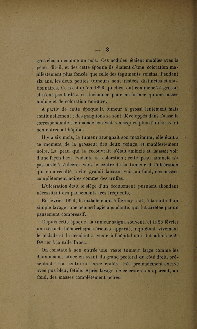 gros chacun comme un pois. Ces nodules étaient mobiles avec la peau, dit-il, et dès cette époque ils étaient d’une coloration ma¬ nifestement plus foncée que celle des téguments voisins. Pendant six ans, les deux petites tumeurs sont restées distinctes et sta¬ tionnaires. Ce n’est qu’en 1896 qu’elles ont commencé à grossir et n'ont pas tardé à se fusionner pour ne former qu'une masse mobile et de coloration noirâtre. A partir de celte époque la tumeur a grossi lentement mais continuellement ; des ganglions se sont développés dans l’aisselle correspondante ; le malade les avait remarqués plus d’un an avant son entrée à l’hôpital. Il y a six mois, la tumeur atteignait son maximum, elle était à ce moment de la grosseur des deux poings, et manifestement noire. La peau qui la recouvrait s’était amincie et laissait voir d’une façon bien évidente sa coloration ; cette peau amincie n’a pas tardé à s’ulcérer vers le centre de la tumeur et l’ulcération qui en a résulté a vite grandi laissant voir, au fond, des masses complètement noires comme des truffes. L’ulcération était le siège d’un écoulement purulent abondant nécessitant des pansements très fréquents. En février 1899, le malade étant à Bernay, eut, à la suite d’un simple lavage, une hémorrhagie abondante, qui fut arrêtée par un pansement compressif. Depuis cette époque, la tumeur saigna souvent, et le 23 février une seconde hémorrhagie sérieuse apparut, inquiétant vivement le malade et le décidant à venir à l’hôpital où il fut admis le 2a février à la salle Broca. On constate à son entrée une vaste tumeur large comme les deux mains, située en avant du grand pectoral du côté droit, pré¬ sentant à son centre un large cratère très profondément excavé avec pus bleu, fétide. Après lavage de ce cratère on aperçoit, au fond, des masses complètement noires.