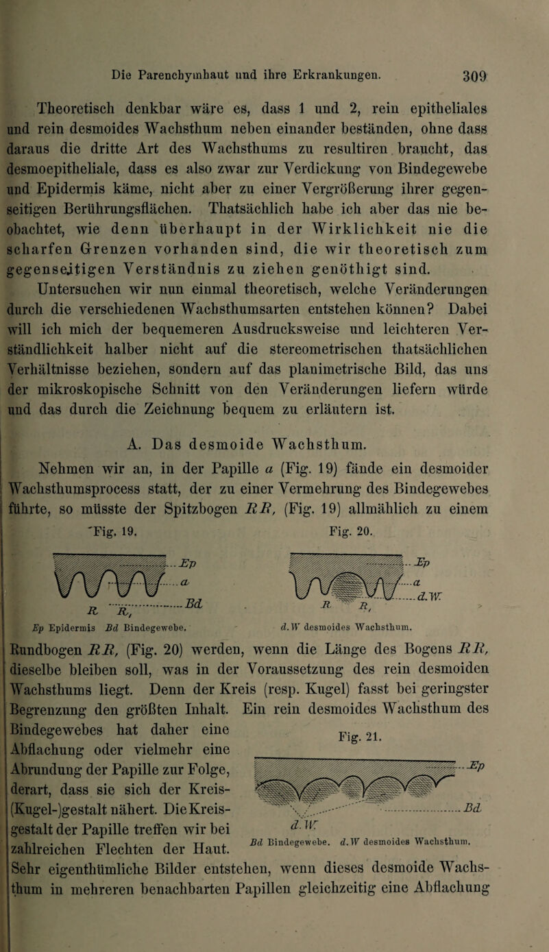 Tkeoretisch denkbar ware es, dass 1 und 2, rein epitkeliales und rein desmoides Wackstkum neben einander bestlinden, ohne dass daraus die dritte Art des Wachsthums zu resultiren brauckt, das desmoepitheliale, dass es also zwar zur Yerdickung yon Bindegewebe und Epidermis kame, nicht aber zu einer YergroBerung ihrer gegen- seitigen Beriihrungsflaclien. Thatsachlich babe ich aber das nie be- obacktet, wie denn iiberhaupt in der Wirklichkeit nie die scbarfen Grrenzen vorhanden sind, die wir tbeoretiscb zum gegensedtigen Yerstandnis zu ziehen genothigt sind. Untersuchen wir nun einmal tbeoretiscb, welcbe Veninderungen durch die verscbiedenen Wacbstbumsarten entsteben konnen? Dabei will icb micb der bequemeren Ausdrucksweise und leicbteren Yer- standlichkeit balber nicbt auf die stereometriscben thatsacblicben Yerhaltnisse bezieken, sondern auf das planimetrische Bild, das uns der mikroskopische Schnitt von den Yeranderungen liefern wiirde und das durch die Zeichnung bequem zu erlautern ist. A. Das desmoide Wacbstbum. Nebmen wir an, in der Papille a (Fig. 19) fande ein desmoider Wacbstbumsprocess statt, der zu einer Yermekrung des Bindegewebes j fubrte, so miisste der Spitzbogen UB, (Fig. 19) allmahlich zu einem 'Fig. 19. Fig. 20. Ep Epidermis Bd Bindegewebe. d.W desmoides Wacbstbum. Rundbogen RR, (Fig. 20) werden, wenn die Lange des Bogens RR, dieselbe bleiben soli, was in der Voraussetzung des rein desmoiden Wachsthums liegt. Denn der Kreis (resp. Kugel) fasst bei geringster Begrenzung den groBten Inbalt. Ein rein desmoides Wacbstbum des Bindegewebes bat daher eine Abflacbung oder vielmehr eine Abrundung der Papille zur Folge, derart, dass sie sicb der Kreis- (Kugel-)gestalt nabert. DieKreis- gestalt der Papille trelfen wir bei i -i • -j , . -i tt i. Bd Bindegewebe. d.W desmoides Wacbstbum. zahlreichen Flecbten der Haut. Sehr eigentkiimliche Bilder entsteben, wenn dieses desmoide Wacbs¬ tbum in mehreren benacbbarten Papillen gleicbzeitig* eine Abflacbung I
