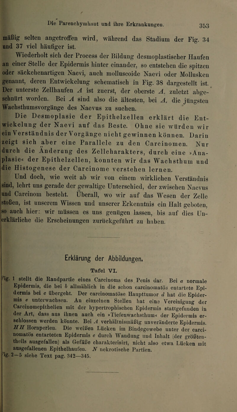 maBig selten angetroffen wird, wahrend das Stadium der Fig. 34 und 37 viel haufiger ist. Wiederholt sicli der Process der Bildung desmoplastischer Haufen an einer Stelle der Epidermis liinter einander, so entstelien die spitzen Oder sackchenartigen Naevi, auch molluscoide Naevi oder Mollusken genannt, deren Entwickelung scliematisch in Fig. 38 dargestellt ist. Der unterste Zellhaufen A ist zuerst, der oberste A. zuletzt abge- schniut woiden. Bei A sind also die altesten? bei A, die jiingsteu Wachsthumsvorgange des Naevus zu snchen. Die Desmoplasie der Epithelzellen erklart die Ent¬ wickelung der Naevi auf das Beste. Ohne sie wiirden wir ein Verstandnis der Vorgange nicht gewinnen konnen. Darin I zeigt sicb aber eine Par allele zu den Carcinomen. Nur durcb die Anderung des Zellcharakters, durch eine »Ana- ;plasie« der Epithelzellen, konnten wir das Wachsthum und idie Histogenese der Carcinome verstehen lernen. Und dock, wie weit ab wir von einem wirklicben Verstandnis sind, lehrt uns gerade der gewaltige Untersebied, der zwischen Naevus und Carcinom besteht. Uberall, wo wir auf das Wesen der Zelle istoBen, ist unserem Wissen und unserer Erkenntnis ein Halt geboten, :so aucb hier: wir mussen es uns geniigen lassen, bis auf dies Un- erklarlicbe die Ersckeinungen zuruckgefuhrt zu haben. Erklarung der Abbildungen, Tafel VI. 7ig. 1 stellt die Randpartie eines Carcinoma des Penis dar. Bei a normale Epidermis, die bei b allmahlich in die schon carcinomatds entartete Epi¬ dermis bei c iibergeht. Der carcinomatdse Haupttumor d hat die Epider¬ mis g unten\achsen. An einzelnen Stellen hat eine Vereinigung der Carcinomepithelien mit der hypertrophischen Epidermis stattgefuuden in der Art, dass aus ihnen auch ein »Tiefenwachsthum« der Epidermis er- schlossen werden kdnnte. Bei A verhaltnismaGig unveriinderte Epidermis. Hli Hornperlen. Die weiGen Liicken im Bindegewebe unter der carci- nomatos entarteten Epidermis c durch Wandung und Inhalt (der grdGten- theils ausgefallen) als GefaGe charakterisirt, nicht also etwa Liicken mit ansgefallenen Epithelhaufen. N nekrotische Partien. 'ig. 2—5 siehe Text pag. 342—345.