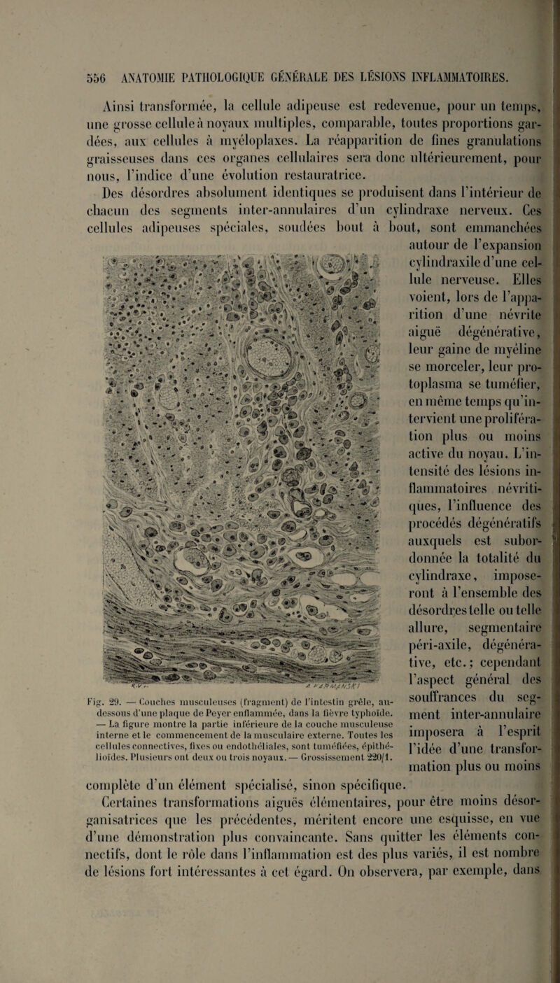 Ainsi transformée, la cellule adipeuse est redevenue, pour un temps, une grosse cellule à noyaux multiples, comparable, toutes proportions gar¬ dées, aux cellules à myéloplaxes. La réapparition de fines granulations graisseuses dans ces organes cellulaires sera donc ultérieurement, pour nous, l’indice d’une évolution restauratrice. Des désordres absolument identiques se produisent dans l’intérieur de chacun des segments inter-annulaires d’un cvlindraxe nerveux. Ces o v cellules adipeuses spéciales, soudées bout à bout, sont emmanchées autour de l’expansion - -J! . •• • ' cylindraxile d’une cel¬ lule nerveuse. Elles voient, lors de l’appa¬ rition d’une névrite aiguë dégénérative, leur gaine de myéline se morceler, leur pro¬ toplasma se tuméfier, en même temps qu’in¬ tervient une proliféra¬ tion plus ou moins active du noyau. L’in¬ tensité des lésions in¬ flammatoires névriti- ques, l’influence des procédés dégénératifs auxquels est subor¬ donnée la totalité du cylindraxe, impose¬ ront à l’ensemble des désordres telle ou telle allure, segmentaire péri-axile, dégénéra¬ tive, etc.; cependant l’aspect général des Fig. 29. — Couches musculeuses (fragment) de l’intestin grêle, au- dessous d’une plaque de Peyer enflammée, dans la fièvre typhoïde. — La figure montre la partie inférieure de la couche musculeuse interne elle commencement de la musculaire externe. Toutes les cellules connectives, fixes ou endothéliales, sont tuméfiées, épithé¬ lioïdes. Plusieurs ont deux ou trois noyaux.— Grossissement 220/1. souffrances du seg¬ ment inter-annulaire imposera à l’esprit l’idée d’une transfor¬ mation plus ou moins complète d’un élément spécialisé, sinon spécifique. Certaines transformations aiguës élémentaires, pour être moins désor- ganisatrices que les précédentes, méritent encore une esquisse, en vue d’une démonstration plus convaincante. Sans quitter les éléments con¬ nectifs, dont le rôle dans l’inflammation est des plus variés, il est nombre de lésions fort intéressantes à cet égard. On observera, par exemple, dans