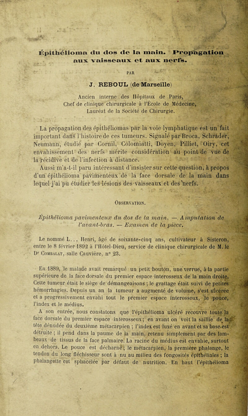 aux. vaisseaux et aux nerfs. PAR J. REBOUL (deMarseille) IgÉ Ancien interne des Hôpitaux de Paris, Chef de clinique chirurgicale à l’École de Médecine, Lauréat de la Société de Chirurgie. La propagation des épithéliomas par la voie lymphatique est un fait important dans l’histoire de ces tumeurs. Signalé par Broca, Schrader, Neumann, étudié par Corail, Colomiatti, Doyen, Pilliet, Oiry, cet envahissement des nerfs mérite considération au point de vue de la récidive et de l’infection à distance. Aussi m’a-t-il paru intéressant d’insister sur cette question, à propos d’un épithélioma pavimenteux de la face dorsale de la main dans lequel j’ai pu étudier les lésions des vaisseaux et des’nerfs. Observation. Epithélioma pavimenteux du dos de la main. — Amputation de Vavant-bras. — Examen de la pièce. Le nommé L... Henri, âgé de soixante-cinq ans, cultivateur à Sisteron, entre le 8 février 1892 à l’Hôtel-Dieu, service de clinique chirurgicale de M. le Dr Combalat, salle Cauvière, n° 23. En 1889, le malade avait remarqué un petit bouton, une verrue, à la partie supérieure de la face dorsale du premier espace interosseux de la main droite. Cette tumeur était le siège de démangeaisons ; le grattage était suivi de petites hémorrhagies. Depuis un an la tumeur a augmenté de volume, s’est Ulcérée et a progressivement envahi tout le premier espace interosseux, le pouce, l’index et le médius. A son entrée, nous constatons que l’épithélioma ulcéré recouvre toute la face dorsale du premier espace interosseux; en avant on voit la saillie de la tète dénudée du deuxième métacarpien ; l’index est luxé en avant et sa base est détruite ; il pend dans la paume de la main, retenu simplement par des lam¬ beaux de tissus de la face palmaire. La racine du médius est envahie, surtout en dehors. Le pouce est décharné ; le métacarpien, la première phalange, le tendon du long fléchisseur sont à nu au milieu des fongosités épithéliales ; la phalangette est sphacélée par défaut de nutrition. En haut l’épithélioma