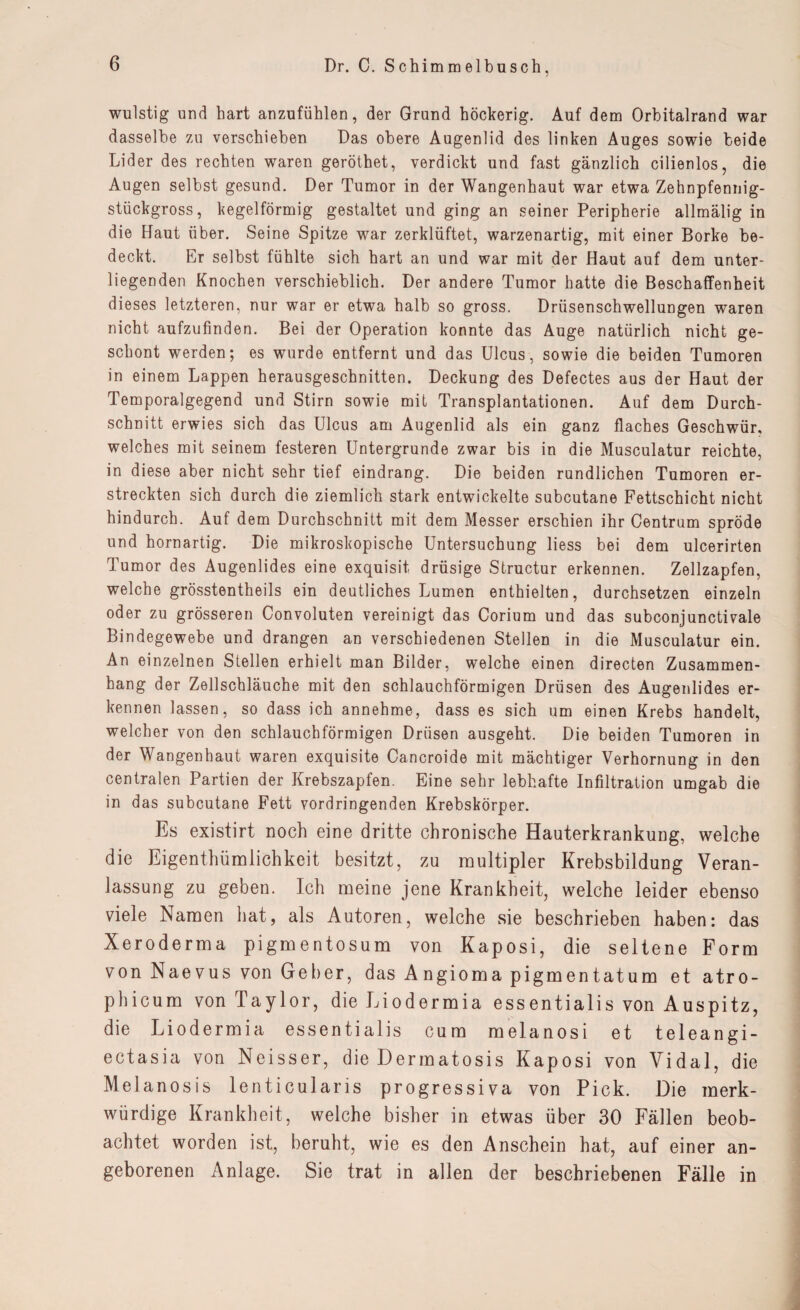 wulstig und hart anzufühlen, der Grund höckerig. Auf dem Orbitalrand war dasselbe zu verschieben Das obere Augenlid des linken Auges sowie beide Lider des rechten waren geröthet, verdickt und fast gänzlich cilienlos, die Augen selbst gesund. Der Tumor in der Wangenhaut war etwa Zehnpfennig¬ stückgross, kegelförmig gestaltet und ging an seiner Peripherie allmälig in die Haut über. Seine Spitze war zerklüftet, warzenartig, mit einer Borke be¬ deckt. Er selbst fühlte sich hart an und war mit der Haut auf dem unter¬ liegenden Knochen verschieblich. Der andere Tumor hatte die Beschaffenheit dieses letzteren, nur war er etwa halb so gross. Drüsenschwellungen waren nicht aufzufinden. Bei der Operation konnte das Auge natürlich nicht ge¬ schont werden; es wurde entfernt und das Ulcus, sowie die beiden Tumoren in einem Lappen herausgeschnitten. Deckung des Defectes aus der Haut der Temporalgegend und Stirn sowie mit Transplantationen. Auf dem Durch¬ schnitt erwies sich das Ulcus am Augenlid als ein ganz flaches Geschwür, welches mit seinem festeren Untergründe zwar bis in die Musculatur reichte, in diese aber nicht sehr tief eindrang. Die beiden rundlichen Tumoren er¬ streckten sich durch die ziemlich stark entwickelte subcutane Fettschicht nicht hindurch. Auf dem Durchschnitt mit dem Messer erschien ihr Centrum spröde und hornartig. Die mikroskopische Untersuchung liess bei dem ulcerirten Tumor des Augenlides eine exquisit drüsige Structur erkennen. Zellzapfen, welche grösstentheils ein deutliches Lumen enthielten, durchsetzen einzeln oder zu grösseren Convoluten vereinigt das Corium und das subconjunctivale Bindegewebe und drangen an verschiedenen Stellen in die Musculatur ein. An einzelnen Stellen erhielt man Bilder, welche einen directen Zusammen¬ hang der Zellschläuche mit den schlauchförmigen Drüsen des Augenlides er¬ kennen lassen, so dass ich annehme, dass es sich um einen Krebs handelt, welcher von den schlauchförmigen Drüsen ausgeht. Die beiden Tumoren in der Wangenhaut waren exquisite Cancroide mit mächtiger Verhornung in den centralen Partien der Krebszapfen. Eine sehr lebhafte Infiltration umgab die in das subcutane Fett vordringenden Krebskörper. Es existirt noch eine dritte chronische Hauterkrankung, welche die Eigenthümlichkeit besitzt, zu multipler Krebsbildung Veran¬ lassung zu geben. Ich meine jene Krankheit, welche leider ebenso viele Namen hat, als Autoren, welche sie beschrieben haben: das Xeroderma pigmentosum von Kaposi, die seltene Form von Naevus von Geber, das Angioma pigmentatum et atro- phicum von Taylor, die Liodermia essentialis von Auspitz, die Liodermia essentialis cum melanosi et teleangi- ectasia von Neisser, die Dermatosis Kaposi von Vidal, die Melanosis lenticularis progressiva von Pick. Die merk¬ würdige Krankheit, welche bisher in etwas über 30 Fällen beob¬ achtet worden ist, beruht, wie es den Anschein hat, auf einer an¬ geborenen Anlage. Sie trat in allen der beschriebenen Fälle in