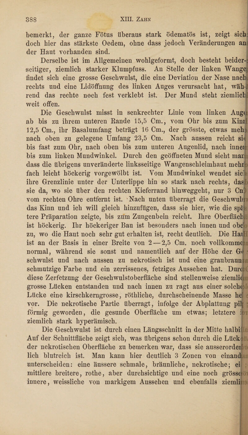 bemerkt, der ganze Fötus überaus stark ödematös ist, zeigt sichi doch hier das stärkste Oedem, ohne dass jedoch Veränderungen an; der Haut vorhanden sind. Derselbe ist im Allgemeinen wohlgeformt, doch besteht beider¬ seitiger, ziemlich starker Klumpfuss. An Stelle der linken Wange; findet sich eine grosse Geschwulst, die eine Deviation der Nase nach rechts und eine Lidöffnung des linken Auges verursacht hat, wäh-i rend das rechte noch fest verklebt ist. Der Mund steht ziemlich- weit offen. Die Geschwulst misst in senkrechter Linie vom linken Augd ab bis zu ihrem unteren Rande 15,5 Cm., vom Ohr bis zum Kimi 12,5 Cm., ihr Basalumfang beträgt 16 Cm., der grösste, etwas mein nach oben zu gelegene Umfang 23,5 Cm. Nach aussen reicht sh; bis fast zum Ohr, nach oben bis zum unteren Augenlid, nach innen bis zum linken Mundwinkel. Durch den geöffneten Mund sieht mar dass die übrigens unveränderte linksseitige Waugenschleimhaut mehr « fach leicht höckerig vorgewölbt ist. Vom Mundwinkel wendet sicr ihre Grenzlinie unter der Unterlippe hin so stark nach rechts, das] sie da, wo sie über den rechten Kieferrand hinweggeht, nur 3 Cm vom rechten Ohre entfernt ist. vNach unten überragt die Gesehwukp das Kinn und ich will gleich hinzufügen, dass sie hier, wie die spL tere Präparation zeigte, bis zum Zungenbein reicht. Ihre Oberfläche ist höckerig. Ihr höckeriger Bau ist besonders nach innen und obe zu, wo die Haut noch sehr gut erhalten ist, recht deutlich. Die Hail ist an der Basis in einer Breite von 2-—2,5 Cm. noch vollkomme] normal, während sie sonst und namentlich auf der Höhe der, Gr schwulst und nach aussen zu nekrotisch ist und eine graubraun j schmutzige Farbe und ein zerrissenes, fetziges Aussehen hat. Dum diese Zerfetzung der Geschwulstoberfläche sind stellenweise ziemlili grosse Lücken entstanden und nach innen zu ragt aus einer solche Lücke eine kirschkerngrosse, röthliche, durchscheinende Masse he vor. Die nekrotische Partie überragt, infolge der Abplattung pilj förmig geworden, die gesunde Oberfläche um etwas; letztere k ziemlich stark hyperämisch. Die Geschwulst ist durch einen Längsschnitt in der Mitte halbi Auf der Schnittfläche zeigt sich, was übrigens schon durch die Lück: der nekrotischen Oberfläche zu bemerken war, dass sie ausserordeil lieh blutreich ist. Man kann hier deutlich 3 Zonen von einand; unterscheiden: eine äussere schmale, bräunliche, nekrotische; ei mittlere breitere, rothe, aber durchsichtige und eine noch grosse; iunere, weissliche von markigem Aussehen und ebenfalls ziemlh eOi