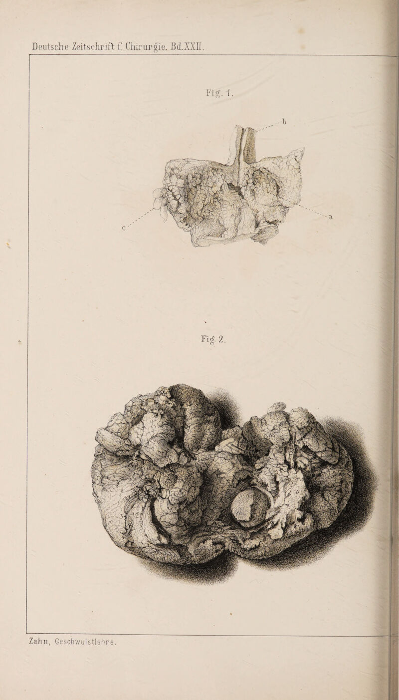 Deutsche Zeitschrift f.' Chirurgie. Dd.XXII 1.