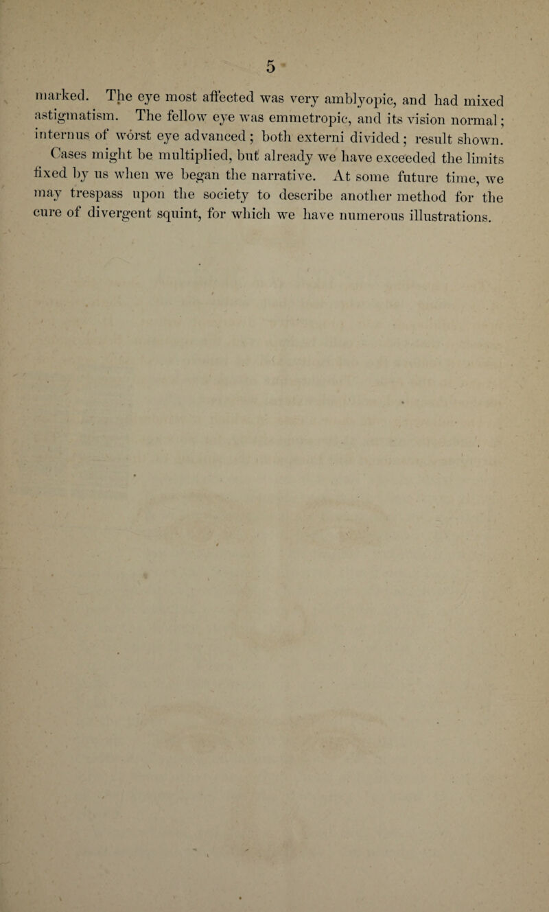 marked. The eye most affected was very amblyopic, and had mixed ^ , y e was emmetropic, and its vision normal; interims of worst eye advanced ; both externi divided; result shown. Cases might be multiplied, but already we have exceeded the limits fixed by us when we began the narrative. At some future time, we may trespass upon the society to describe another method for the cure of divergent squint, for which we have numerous illustrations.