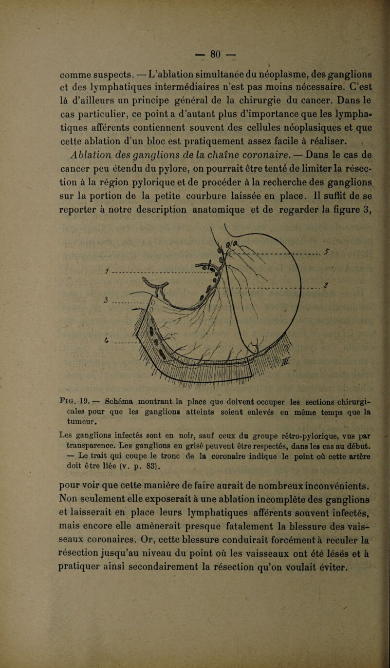 — 80 — comme suspects. — L’ablation simultanée du néoplasme, des ganglions et des lymphatiques intermédiaires n’est pas moins nécessaire. C’est là d’ailleurs un principe général de la chirurgie du cancer. Dans le cas particulier, ce pointa d’autant plus d’importance que les lympha¬ tiques afférents contiennent souvent des cellules néoplasiques et que cette ablation d’un bloc est pratiquement assez facile à réaliser. Ablation des ganglions de la chaîne coronaire. — Dans le cas de cancer peu étendu du pylore, on pourrait être tenté de limiter la résec¬ tion à la région pylorique et de procéder à la recherche des ganglions reporter à notre description anatomique et de regarder la figure 3, Fig. 19. — Schéma montrant la place que doivent occuper les sections chirurgi¬ cales pour que les ganglions atteints soient enlevés en même temps que la tumeur. Les ganglions infectés sont en noir, sauf ceux du groupe rétro-pylorique, vus par transparence. Les ganglions en grisé peuvent être respectés, dans les cas au début. — Le trait qui coupe le tronc de la coronaire indique le point où cette artère doit être liée (v. p. 83). pour voir que cette manière de faire aurait de nombreux inconvénients. Non seulement elle exposerait à une ablation incomplète des ganglions et laisserait en place leurs lymphatiques afférents souvent infectés, mais encore elle amènerait presque fatalement la blessure des vais¬ seaux coronaires. Or, cette blessure conduirait forcément à reculer la résection jusqu’au niveau du point où les vaisseaux ont été lésés et à pratiquer ainsi secondairement la résection qu’on voulait éviter. t *