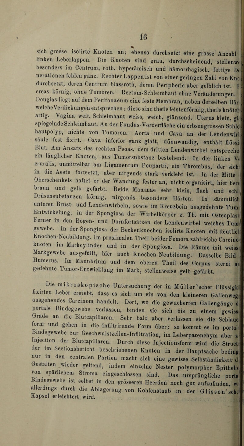 sich grosse isolirte Knoten an; ebenso durchsetzt eine grosse Anzahl l linken Leberlappen. Die Knoten sind grau, durchscheinend, stellenw« ] besonders im Centrum, roth, hyperämisch und hämorrhagisch, fettige D< .1 nerationen fehlen ganz. Rechter Lappen ist von einer geringen Zahl von Knc durchsetzt, deren Centrum blassroth, deren Peripherie aber gelblich ist. f . creas körnig, ohne Tumoren. Reetum-Scbleimhaut ohne Veränderungen, j Douglas liegt auf dem Peritonaeum eine feste Membran, neben derselben Här welcheVerdickungen entsprechen; diese sind theils leistenförmig, theils knotet ’ artig. Vagina weit, Schleimhaut weiss, weich, glänzend. Uterus klein, gli > spiegelnde Schleimhaut. An der h undus-Vorderfläche ein erbsengrossen Schle | hautpolyp, nichts von Tumoren. Aorta und Cava an der Lendenwirl säule fest fixirt. Cava inferior ganz glatt, dünnwandig, enthält flüssi i Blut. Am Ansatz des rechten Psoas, dem dritten Lendenwirbel entspreche ein länglicher Knoten, aus Tumorsubstanz bestehend. In der linken Vi cruralis, unmittelbar am Ligamentum Poupartii, ein Thrombus, der sich m die Aeste fortsetzt, aber nirgends stark verklebt ist. ln der Mitte Oberschenkels haftet er der Wandung fester an, nicht organisirt, hier ben braun und gelb gefärbt. Beide Mammae sehr klein, flach und schl ■ Drüsensubstanzen körnig, nirgends besondere Härten. In sämmtlict unteren Brust- und Lendenwirbeln, sowie im Kreuzbein ausgedehnte Tum : Entwickelung, in der Spongiosa der Wirbelkörper z. Th. mit Osteoplasl Ferner in den Bogen- und Dornfortsätzen der Lendenwirbel weiches Tum - gewebe. In der Spongiosa der Beckenknochen isolirte Knoten mit deutlicl Knochen-Neubildung. Im proximalen Theil beider Femora zahlreiche Carcino ; knoten im Markcylinder und in der Spongiosa. Die Räume mit weiss Markgewebe ausgefüllt, hier auch Knochen-Neubildung. Dasselbe Bild Humerus. Im Manubrium und dem oberen Theil des Corpus sterni ai gedehnte Tumor-Entwicklung im Mark, stellenweise gelb gefärbt. Die mikroskopische Untersuchung der in Müller’scher Flüssigk fixirten Leber ergiebt, dass es sich um ein von den kleineren Gallenweg ausgehendes Carcinom handelt. Dort, wo die gewucherten Gallengänge d portale Bindegewebe verlassen, binden sie sich bis zu einem gewiss Grade an die Blutcapillaren. Sehr bald aber verlassen sie die Schlaue form und gehen in die infiltrirende Form über; so kommt es im portal Bindegewebe zur Geschwulstzellen-Infiltration, im Leberpar.enchym aber z Injection der Blutcapillaren. Durch diese Injectionsform wird die Struct der im Sectionsbericht beschriebenen Knoten in der Hauptsache beding nur in den centralen Partien macht sich eine gewisse Selbständigkeit d Gestalten wieder geltend, indem einzelne Nester polymorpher Epitheln von späiliehem Stioma eingeschlossen sind. Das ursprüngliche porta indegewebe ist selbst in den grösseren Heeraen noch gut aufzufinden, w. allerdings durch die Ablagerung von Kohlenstaub in der Glisson’scbi Kapsel erleichtert wird.