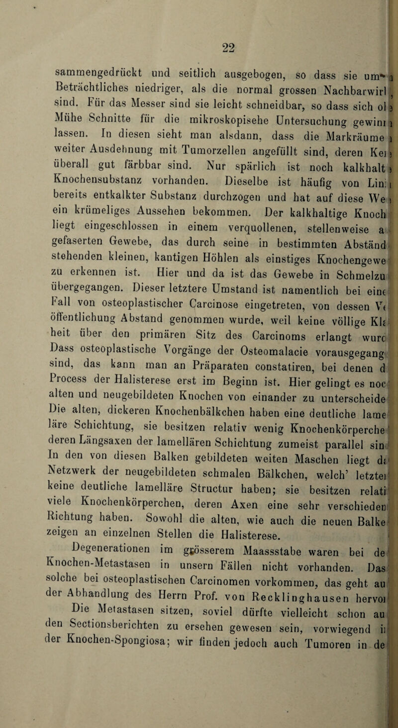 sammengedrückt und seitlich ausgebogen, so dass sie um** q Beträchtliches niedriger, als die normal grossen Nachbarwirl sind. Für das Messer sind sie leicht schneidbar, so dass sich oi 3 Mühe Schnitte für die mikroskopische Untersuchung gewim 1 lassen. In diesen sieht man alsdann, dass die Markräume i weiter Ausdehnung mit Tumorzellen angefüllt sind, deren Ken überall gut färbbar sind. Nur spärlich ist noch kalkhalt > Knochensubstanz vorhanden. Dieselbe ist häufig von Lin: 1 bereits entkalkter Substanz durchzogen und hat auf diese We 1 ein krümeliges Aussehen bekommen. Der kalkhaltige Knoch liegt eingeschlossen in einem verquollenen, stellenweise a gefaserten Gewebe, das durch seine in bestimmten Abständ stehenden kleinen, kantigen Höhlen als einstiges Knochengewe zu erkennen ist. Hier und da ist das Gewebe in Schmelzu übergegangen. Dieser letztere Umstand ist namentlich bei eine fall von osteoplastischer Carcinose eingetreten, von dessen V« öffentlichung Abstand genommen wurde, weil keine völlige Kh heit über den primären Sitz des Carcinoms erlangt wurc Dass osteoplastische \ orgänge der Osteomalacie vorausgegang sind, das kann man an Präparaten constatiren, bei denen d Iiocess dei Halisterese erst im Beginn ist. Hier gelingt es noc alten und neugebildeten Knochen von einander zu unterscheide Die alten, dickeren Knochenbälkchen haben eine deutliche lame lare Schichtung, sie besitzen relativ wenig Knochenkörperchei deren Längsaxen der lamellären Schichtung zumeist parallel sin In den von diesen Balken gebildeten weiten Maschen liegt d« Netzwerk der neugebildeten schmalen Bälkchen, welch’ letzte] keine deutliche lamelläre Structur haben; sie besitzen relati viele Knochenkörperchen, deren Axen eine sehr verschieden Richtung haben. Sowohl die alten, wie auch die neuen Balke zeigen an einzelnen Stellen die Halisterese. * Degenei ationen im grösserem Maassstabe waren bei de Knochen-Metastasen in unsern Fällen nicht vorhanden. Das solche bei osteoplastischen Carcinomen Vorkommen, das geht au der Abhandlung des Herrn Prof, von Recklinghausen hervoi Die Metastasen sitzen, soviel dürfte vielleicht schon au den Sectionsberichten zu ersehen gewesen sein, vorwiegend iij der Knochen-Spongiosa; wir finden jedoch auch Tumoren in de