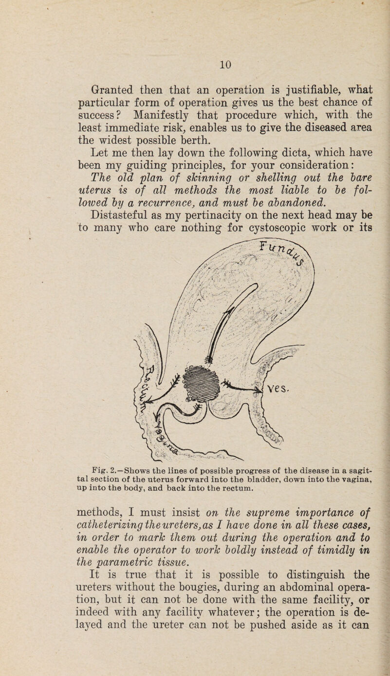 Granted then that an operation is justifiable, what particular form of operation gives us the best chance of success? Manifestly that procedure which, with the least immediate risk, enables us to give the diseased area the widest possible berth. Let me then lay down the following dicta, which have been my guiding principles, for your consideration: The old 'plan of skinning or shelling out the hare uterus is of all methods the most liable to be fol¬ lowed by a recurrence, and must be abandoned. Distasteful as my pertinacity on the next head may be to many who care nothing for cystoscopic work or its Fig. 2.—Shows the lines of possible progress of the disease in a sagit¬ tal section of the uterus forward into the bladder, down into the vagina, up into the body, and back into the rectum. methods, I must insist on the supreme importance of caiheterizing the ureters, as I have done in all these cases, in order to mark them out during the operation and to enable the operator to wo7'k boldly instead of timidly in the parametric tissue. It is true that it is possible to distinguish the ureters without the bougies, during an abdominal opera¬ tion, but it can not be done with the same facility, or indeed with any facility whatever; the operation is de¬ layed and the ureter can not be pushed aside as it can