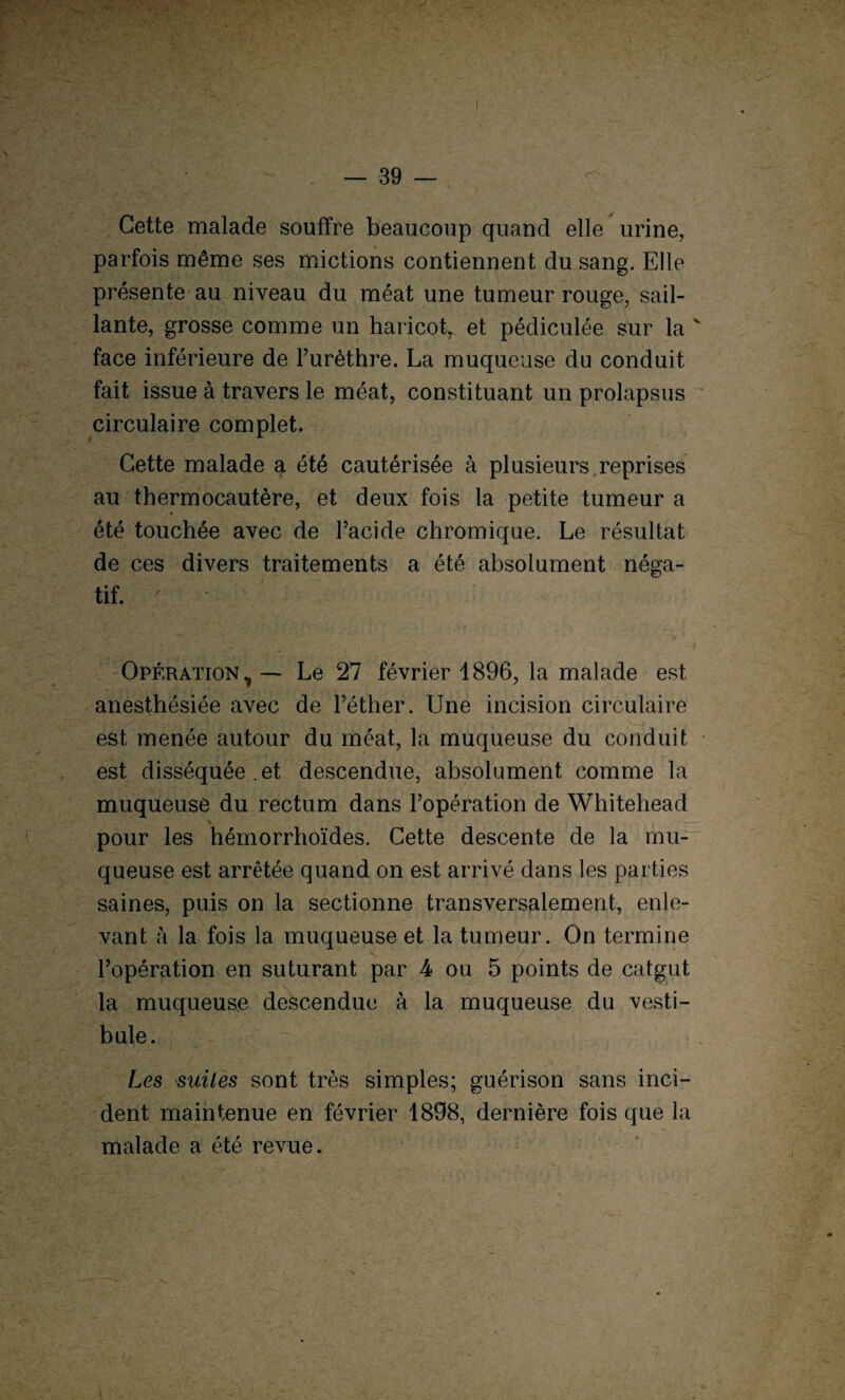 Cette malade souffre beaucoup quand elle urine, parfois même ses mictions contiennent du sang. Elle présente au niveau du méat une tumeur rouge, sail¬ lante, grosse comme un haricot, et pédiculée sur la face inférieure de Furèthre. La muqueuse du conduit fait issue à travers le méat, constituant un prolapsus circulaire complet. Cette malade a été cautérisée à plusieurs reprises au thermocautère, et deux fois la petite tumeur a été touchée avec de l’acide chromique. Le résultat de ces divers traitements a été absolument néga¬ tif. ' Opération, — Le 27 février 1896, la malade est anesthésiée avec de l’éther. Une incision circulaire est menée autour du méat, la muqueuse du conduit est disséquée.et descendue, absolument comme la muqueuse du rectum dans l’opération de Whitehead pour les hémorrhoïdes. Cette descente de la mu¬ queuse est arrêtée quand on est arrivé dans les parties saines, puis on la sectionne transversalement, enle¬ vant à la fois la muqueuse et la tumeur. On termine l’opération en suturant par 4 ou 5 points de catgut la muqueuse descendue à la muqueuse du vesti¬ bule. Les suites sont très simples; guérison sans inci¬ dent maintenue en février 1898, dernière fois que la malade a été revue.