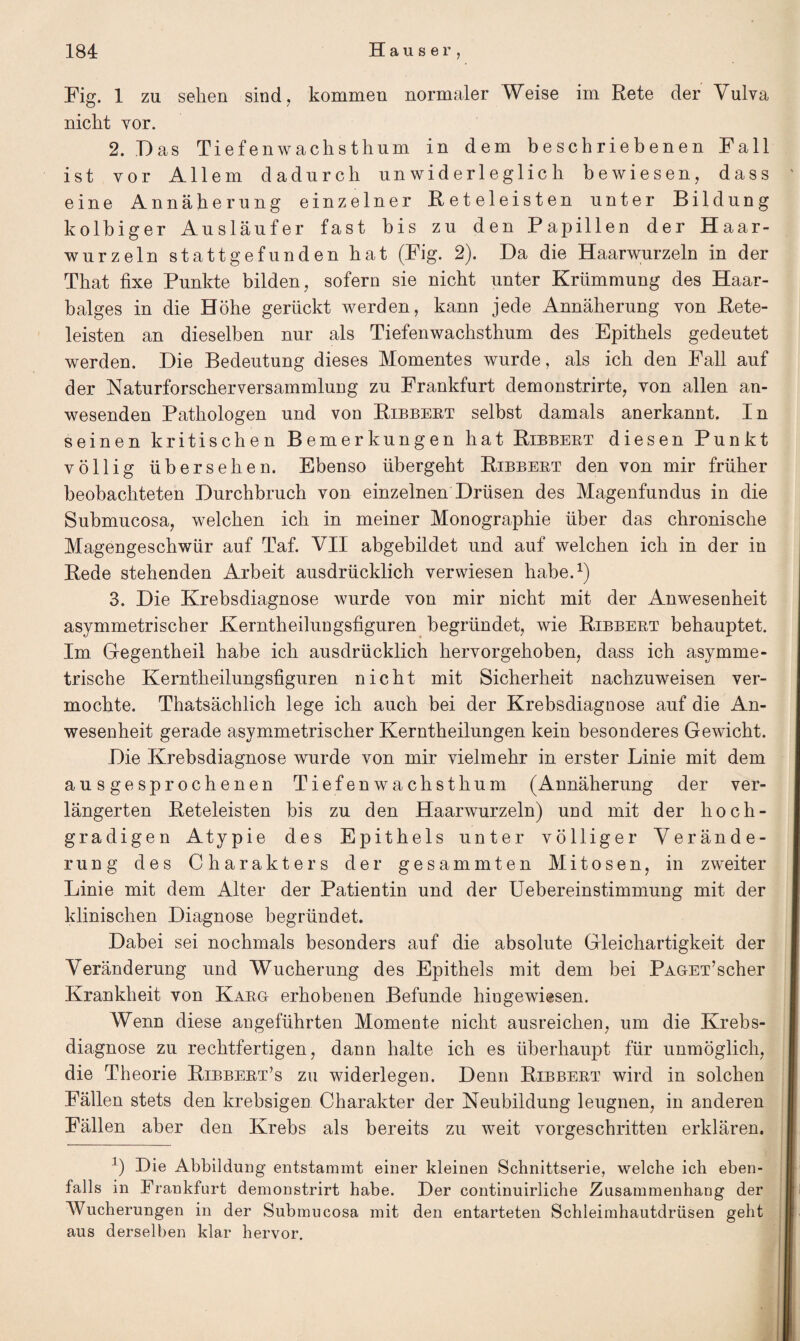 Fig. 1 zu sehen sind, kommen normaler Weise im Rete der Vulva nicht vor. 2. Das Tiefen wach st hum in dem beschriebenen Fall ist vor Allem dadurch unwiderleglich bewiesen, dass eine Annäherung einzelner Reteleisten unter Bildung kolbiger Ausläufer fast bis zu den Papillen der Haar¬ wurzeln stattgefunden hat (Fig. 2). Da die Haarwurzeln in der That fixe Punkte bilden, sofern sie nicht unter Krümmung des Haar¬ balges in die Höhe gerückt werden, kann jede Annäherung von Rete¬ leisten an dieselben nur als Tiefenwachsthum des Epithels gedeutet werden. Die Bedeutung dieses Momentes wurde, als ich den Fall auf der Naturforscherversammlung zu Frankfurt demonstrirte, von allen an¬ wesenden Pathologen und von Ribbert selbst damals anerkannt. In seinen kritischen Bemerkungen hat Ribbert diesen Punkt völlig übersehen. Ebenso übergeht Ribbert den von mir früher beobachteten Durchbruch von einzelnen Drüsen des Magenfundus in die Submucosa, welchen ich in meiner Monographie über das chronische Magengeschwür auf Taf. VII abgebildet und auf welchen ich in der in Rede stehenden Arbeit ausdrücklich verwiesen habe.1) 3. Die Krebsdiagnose wurde von mir nicht mit der Anwesenheit asymmetrischer Kerntheilungsfiguren begründet, wie Ribbert behauptet. Im Gegentheil habe ich ausdrücklich hervorgehoben, dass ich asymme¬ trische Kerntheilungsfiguren nicht mit Sicherheit nachzuweisen ver¬ mochte. Thatsächlich lege ich auch bei der Krebsdiagnose auf die An¬ wesenheit gerade asymmetrischer Kerntheilungen kein besonderes Gewicht. Die Krebsdiagnose wurde von mir vielmehr in erster Linie mit dem ausgesprochenen Tiefen wachsthum (Annäherung der ver¬ längerten Reteleisten bis zu den Haarwurzeln) und mit der hoch¬ gradigen Atypie des Epithels unter völliger Verände¬ rung des Charakters der gesammten Mitosen, in zweiter Linie mit dem Alter der Patientin und der Uebereinstimmung mit der klinischen Diagnose begründet. Dabei sei nochmals besonders auf die absolute Gleichartigkeit der Veränderung und Wucherung des Epithels mit dem bei Paget’scher Krankheit von Karg erhobenen Befunde hiugewiesen. Wenn diese angeführten Momente nicht ausreichen, um die Krebs¬ diagnose zu rechtfertigen, dann halte ich es überhaupt für unmöglich, die Theorie Ribbert’s zu widerlegen. Denn Ribbert wird in solchen Fällen stets den krebsigen Charakter der Neubildung leugnen, in anderen Fällen aber den Krebs als bereits zu weit vorgeschritten erklären. J) Die Abbildung entstammt einer kleinen Schnittserie, welche ich eben¬ falls in Frankfurt demonstrirt habe. Der continuirliche Zusammenhang der Wucherungen in der Submucosa mit den entarteten Schleimhautdrüsen geht aus derselben klar hervor.