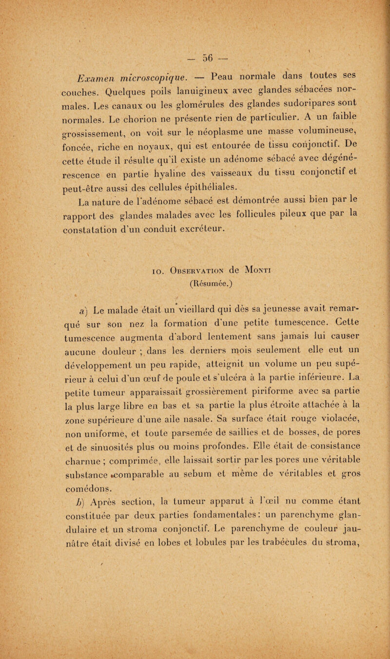 Examen microscopique. — Peau normale dans toutes ses couches. Quelques poils lanuigineux avec glandes sébacées nor¬ males. Les canaux ou les glomérules des glandes sudoripares sont normales. Le chorion ne présente rien de particulier. A un faible Grossissement, on voit sur le néoplasme une masse volumineuse, foncée, riche en noyaux, qui est entourée de tissu conjonctif. De cette étude il résulte qu'il existe un adénome sébacé avec dégéné¬ rescence en partie hyaline des vaisseaux du tissu conjonctif et peut-être aussi des cellules épithéliales. La nature de l'adénome sébacé est démontrée aussi bien par le rapport des glandes malades avec les follicules pileux que par la constatation d’un conduit excréteur. io. Observation de Monti (Résumée.) a) Le malade était un’vieillard qui dès sa jeunesse avait remar¬ qué sur son nez la formation d’une petite tumescence. Cette tumescence augmenta d’abord lentement sans jamais lui causer aucune douleur ; dans les derniers mois seulement elle eut un développement un peu rapide, atteignit un volume un peu supé¬ rieur à celui d’un œuf de poule et s'ulcéra à la partie inférieure. La petite tumeur apparaissait grossièrement piriforme avec sa partie la plus large libre en bas et sa partie la plus étroite attachée à la zone supérieure d’une aile nasale. Sa surface était rouge violacée, non uniforme, et toute parsemée de saillies et de bosses, de pores et de sinuosités plus ou moins profondes. Elle était de consistance charnue ; comprimée, elle laissait sortir parles pores une véritable substance ^comparable au sébum et même de véritables et gros comédons. b) Après section, la tumeur apparut à l’œil nu comme étant constituée par deux parties fondamentales: un parenchyme glan¬ dulaire et un stroma conjonctif. Le parenchyme de couleur jau¬ nâtre était divisé en lobes et lobules par les trabécules du stroma,