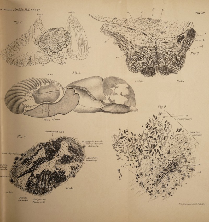 irchoms Archiv. Bd. CLXY1 T(d'Xl[ r.H•• ~> ■, ■ | J ! ■ \ Austreterule ventrale [^K/’ZdY/t da' nerv, xjjk CervicaZ L. fr] i «c KL#*1*?170 W/( seztenstrang m A « FasUc cunttUus Ntudgrac. im Fascic grac. KLane, LithJnsl,Berlin-,
