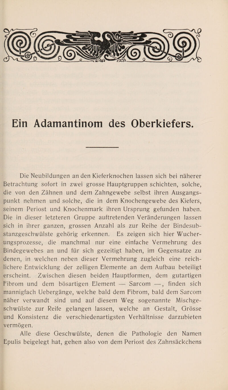 Ein Adamantinom des Oberkiefers. Die Neubildungen an den Kieferknochen lassen sich bei näherer Betrachtung sofort in zwei grosse Hauptgruppen schichten, solche, die von den Zähnen und dem Zahngewebe selbst ihren Ausgangs¬ punkt nehmen und solche, die in dem Knochengewebe des Kiefers, seinem Periost und Knochenmark ihren Ursprung gefunden haben. Die in dieser letzteren Gruppe auftretenden Veränderungen lassen sich in ihrer ganzen, grossen Anzahl als zur Reihe der Bindesub¬ stanzgeschwülste gehörig erkennen. Es zeigen sich hier Wucher¬ ungsprozesse, die manchmal nur eine einfache Vermehrung des Bindegewebes an und für sich gezeitigt haben, im Gegensätze zu denen, in welchen neben dieser Vermehrung zugleich eine reich¬ lichere Entwicklung der zelligen Elemente an dem Aufbau beteiligt erscheint. Zwischen diesen beiden Hauptformen, dem gutartigen Fibrom und dem bösartigen Element — Sarcom —, finden sich mannigfach Uebergänge, welche bald dem Fibrom, bald dem Sarcom näher verwandt sind und auf diesem Weg sogenannte Mischge¬ schwülste zur Reife gelangen lassen, welche an Gestalt, Grösse und Konsistenz die verschiedenartigsten Verhältnisse darzubieten vermögen. Alle diese Geschwülste, denen die Pathologie den Namen Epulis beigelegt hat, gehen also von dem Periost des Zahnsäckchens