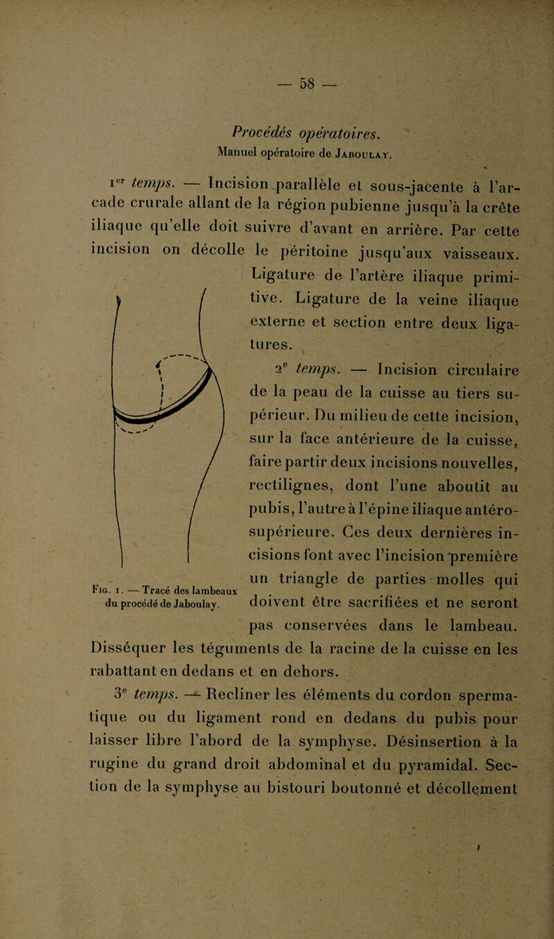 Procédés opératoires. Manuel opératoire de Jaboulày. « i r temps. Incision.parallèle el sous-jacente à l’ar¬ cade crurale allant de la région pubienne jusqu’à la crête iliaque qu’elle doit suivre d’avant en arrière. Par cette incision on décolle le péritoine jusqu’aux vaisseaux. Ligature de l’artère iliaque primi¬ tive. Ligature de la veine iliaque externe et section entre deux liga¬ tures. 2e temps. — Incision circulaire de la peau de la cuisse au tiers su¬ périeur. Du milieu de cette incision, ' $ sur la face antérieure de la cuisse, faire partir deux incisions nouvelles, rectilignes, dont Lune aboutit au pubis, l’autre à l’épine iliaque antéro- supérieure. Ces deux dernières in¬ cisions font avec l’incision'première un triangle de parties molles qui doivent être sacrifiées et ne seront pas conservées dans le lambeau. Disséquer les téguments de la racine de la cuisse en les rabattant en dedans et en dehors. 3e temps. — Recliner les éléments du cordon sperma¬ tique ou du ligament rond en dedans du pubis pour laisser libre l’abord de la symphyse. Désinsertion à la rugine du grand droit abdominal et du pyramidal. Sec¬ tion de la symphyse au bistouri boutonné et décollement tiG. i. — Tracé des lambeaux du procédé de Jaboulay.