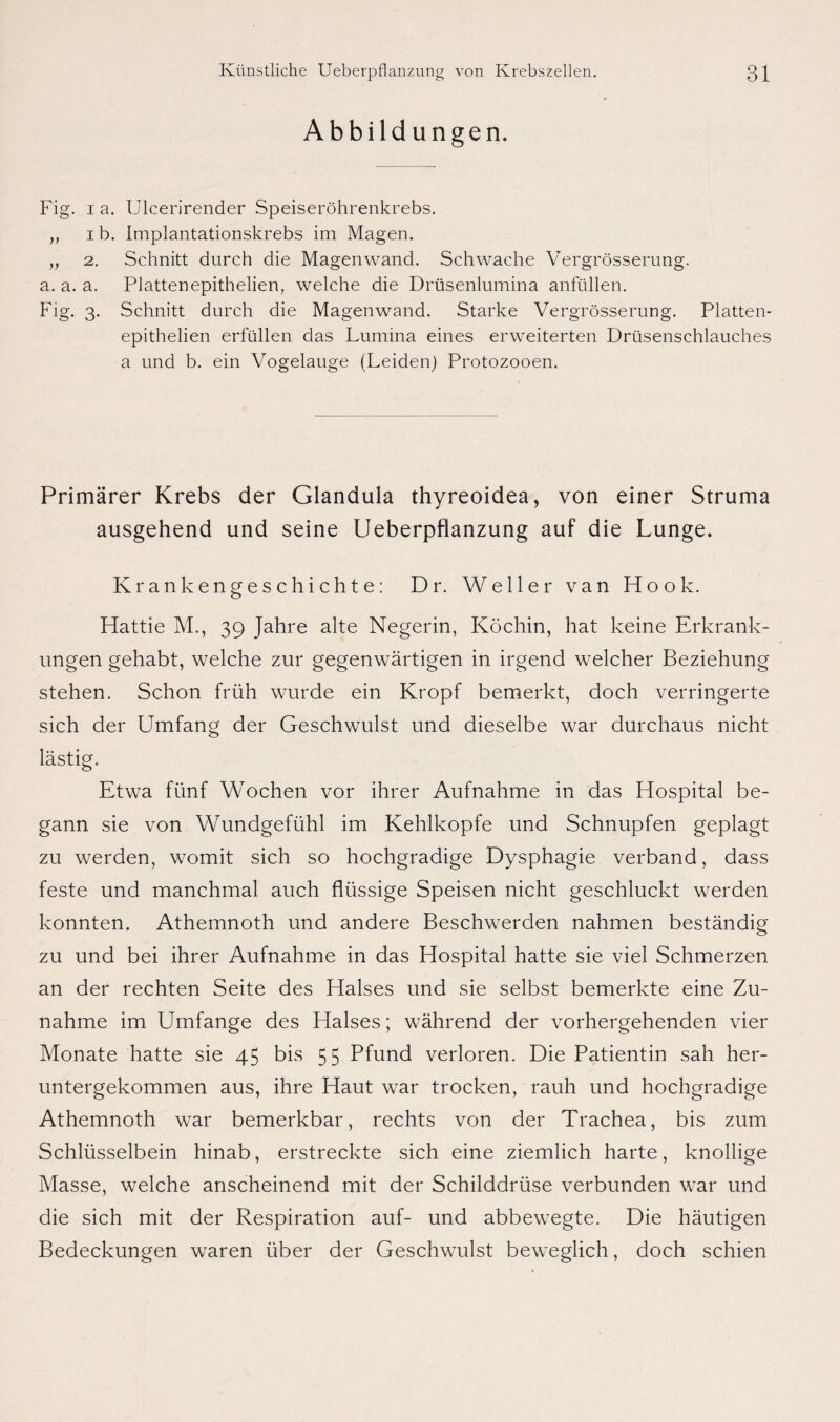 Abbildungen. Fig. i a. Ulcerirender Speiseröhrenkrebs. „ i b. Implantationskrebs im Magen. „ 2. Schnitt durch die Magenwand. Schwache Vergrösserung. a. a. a. Plattenepithelien, welche die Drüsenlumina anfüllen. Fig. 3. Schnitt durch die Magenwand. Starke Vergrösserung. Platten¬ epithelien erfüllen das Lumina eines erweiterten Drüsenschlauches a und b. ein Vogelauge (Leiden) Protozooen. Primärer Krebs der Glandula thyreoidea, von einer Struma ausgehend und seine Ueberpflanzung auf die Lunge. Krankengeschichte: Dr. Weller van Hook. Hattie M., 39 Jahre alte Negerin, Köchin, hat keine Erkrank¬ ungen gehabt, welche zur gegenwärtigen in irgend welcher Beziehung stehen. Schon früh wurde ein Kropf bemerkt, doch verringerte sich der Umfang der Geschwulst und dieselbe war durchaus nicht lästig. Etwa fünf Wochen vor ihrer Aufnahme in das Hospital be¬ gann sie von Wundgefühl im Kehlkopfe und Schnupfen geplagt zu werden, womit sich so hochgradige Dysphagie verband, dass feste und manchmal auch flüssige Speisen nicht geschluckt werden konnten. Athemnoth und andere Beschwerden nahmen beständig zu und bei ihrer Aufnahme in das Hospital hatte sie viel Schmerzen an der rechten Seite des Halses und sie selbst bemerkte eine Zu¬ nahme im Umfange des Halses; während der vorhergehenden vier Monate hatte sie 45 bis 55 Pfund verloren. Die Patientin sah her¬ untergekommen aus, ihre Haut war trocken, rauh und hochgradige Athemnoth war bemerkbar, rechts von der Trachea, bis zum Schlüsselbein hinab, erstreckte sich eine ziemlich harte, knollige Masse, welche anscheinend mit der Schilddrüse verbunden war und die sich mit der Respiration auf- und abbewegte. Die häutigen Bedeckungen waren über der Geschwulst beweglich, doch schien