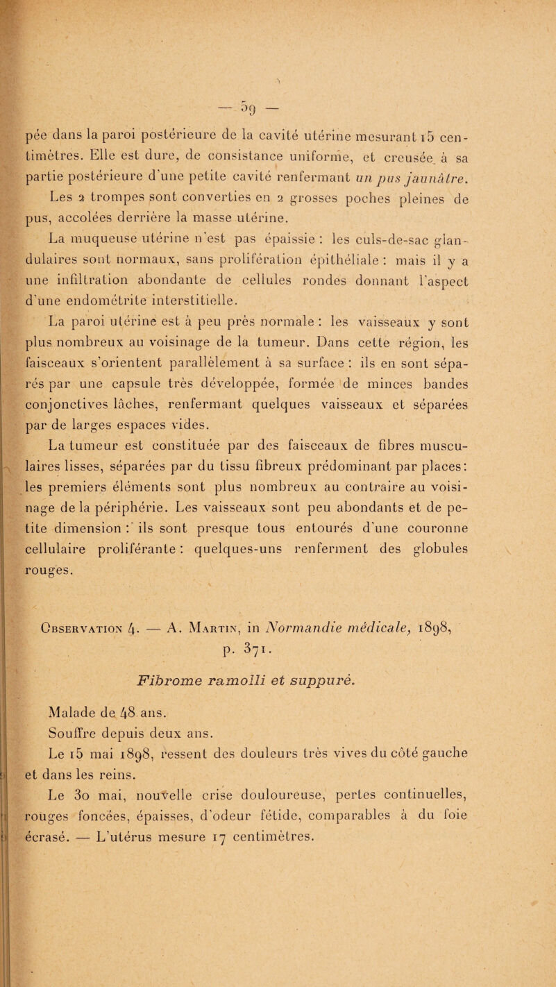 pée dans la paroi postérieure de la cavité utérine mesurant 15 cen¬ timètres. Elle est dure, de consistance uniforme, et creusée à sa partie postérieure d'une petite cavité renfermant un pus jaunâtre. Les 2 trompes sont converties en 2 grosses poches pleines de pus, accolées derrière la masse utérine. La muqueuse utérine n'est pas épaissie : les culs-de-sac glan¬ dulaires sont normaux, sans prolifération épithéliale : mais il y a une infiltration abondante de cellules rondes donnant l’aspect d'une endométrite interstitielle. La paroi utérine est à peu près normale : les vaisseaux y sont plus nombreux au voisinage de la tumeur. Dans cette région, les faisceaux s’orientent parallèlement à sa surface : ils en sont sépa¬ rés par une capsule très développée, formée de minces bandes conjonctives lâches, renfermant quelques vaisseaux et séparées par de larges espaces vides. La tumeur est constituée par des faisceaux de fibres muscu¬ laires lisses, séparées par du tissu fibreux prédominant par places: les premiers éléments sont plus nombreux au contraire au voisi¬ nage delà périphérie. Les vaisseaux sont peu abondants et de pe¬ tite dimension : ils sont presque tous entourés d'une couronne cellulaire proliférante : quelques-uns renferment des globules rouges. Observation 4- — A. Martin, in Normandie medicale, 1898, p. 371. Fibrome ramolli et suppuré« Malade de 48 ans. Souffre depuis deux ans. Le i5 mai 1898, ressent des douleurs très vives du côté gauche et dans les reins. Le 3o mai, nouvelle crise douloureuse, pertes continuelles, rouges foncées, épaisses, d’odeur fétide, comparables à du foie écrasé. — L’utérus mesure 17 centimètres.