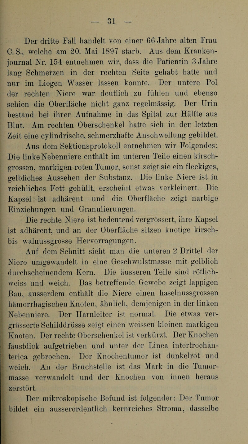 Der dritte Fall handelt von einer 66 Jahre alten Frau C. S., welche am 20. Mai 1897 starb. Aus dem Kranken¬ journal Kr. 154 entnehmen wir, dass die Patientin 3 Jahre lang Schmerzen in der rechten Seite gehabt hatte und nur im Liegen Wasser lassen konnte. Der untere Pol der rechten Niere war deutlich zu fühlen und ebenso schien die Oberfläche nicht ganz regelmässig. Der Urin bestand bei ihrer Aufnahme in das Spital zur Hälfte aus Blut. Am rechten Oberschenkel hatte sich in der letzten Zeit eine cylindrische, schmerzhafte Anschwellung gebildet. Aus dem Sektionsprotokoll entnehmen wir Folgendes: Die linke Nebenniere enthält im unteren Teile einen kirsch¬ grossen, markigen roten Tumor, sonst zeigt sie ein fleckiges, gelbliches Aussehen der Substanz. Die linke Niere ist in reichliches Fett gehüllt, erscheint etwas verkleinert. Die Kapsel ist adhärent und die Oberfläche zeigt narbige Einziehungen und Granulierungen. Die rechte Niere ist bedeutend vergrössert, ihre Kapsel ist adhärent, und an der Oberfläche sitzen knotige kirsch- bis walnussgrosse Hervorragungen. Auf dem Schnitt sieht man die unteren 2 Drittel der Niere umgewandelt in eine Geschwulstmasse mit gelblich durchscheinendem Kern. Die äusseren Teile sind rötlich- weiss und weich. Das betreffende Gewebe zeigt lappigen Bau, ausserdem enthält die Niere einen haselnussgrossen hämorrhagischen Knoten, ähnlich, demjenigen in der linken Nebenniere. Der Harnleiter ist normal. Die etwas ver- grösserte Schilddrüsse zeigt einen weissen kleinen markigen Knoten. Der rechte Oberschenkel ist verkürzt. Der Knochen faustdick aufgetrieben und unter der Linea intertrochan- terica gebrochen. Der Knochentumor ist dunkelrot und weich. An der Bruchstelle ist das Mark in die Tumor¬ masse verwandelt und der Knochen von innen heraus zerstört. Der mikroskopische Befund ist folgender: Der Tumor bildet ein ausserordentlich kernreiches Stroma, dasselbe